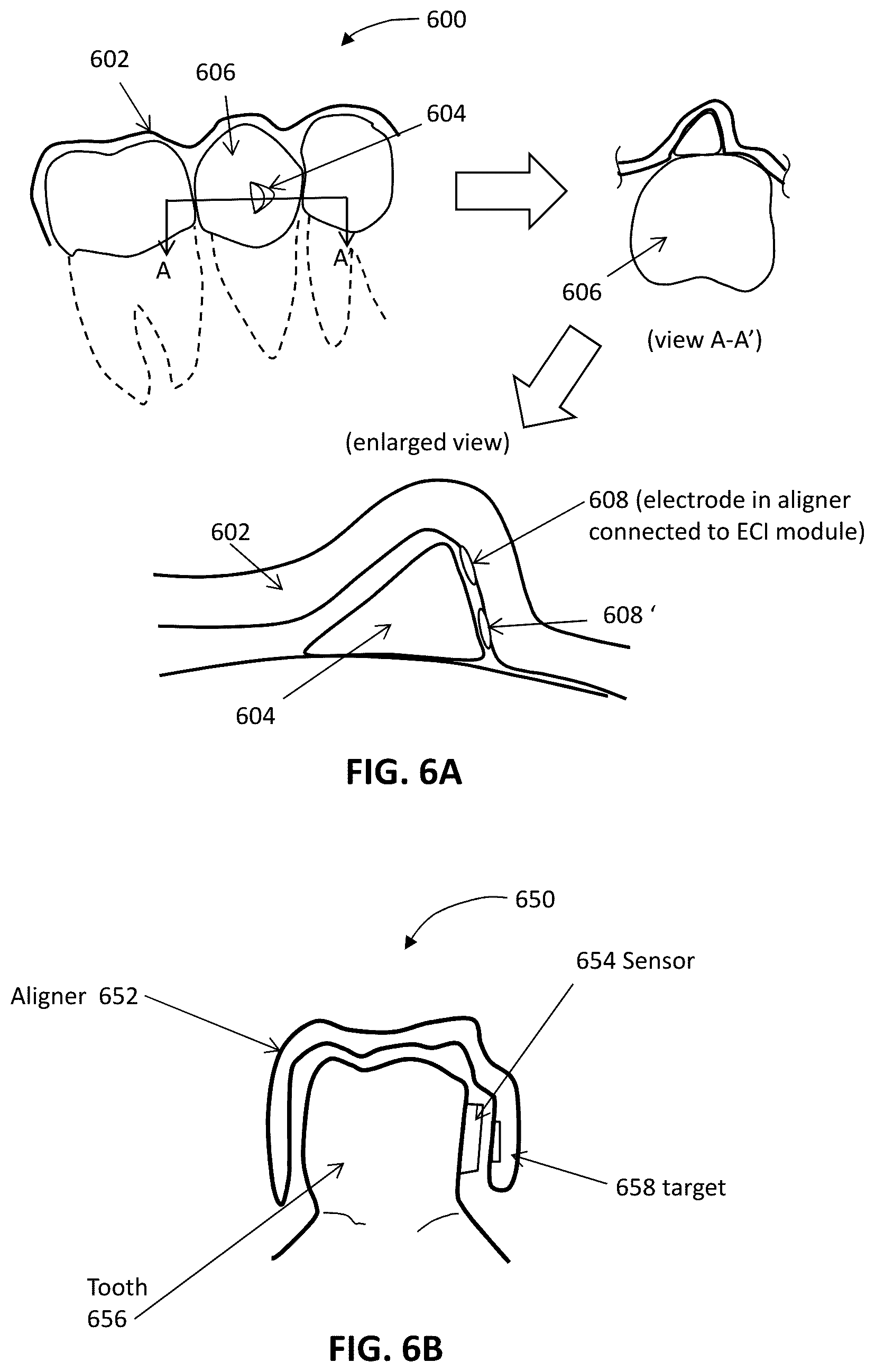 Patent US12508106 Figure 10 – Systems and methods for monitoring orthodontic treatment