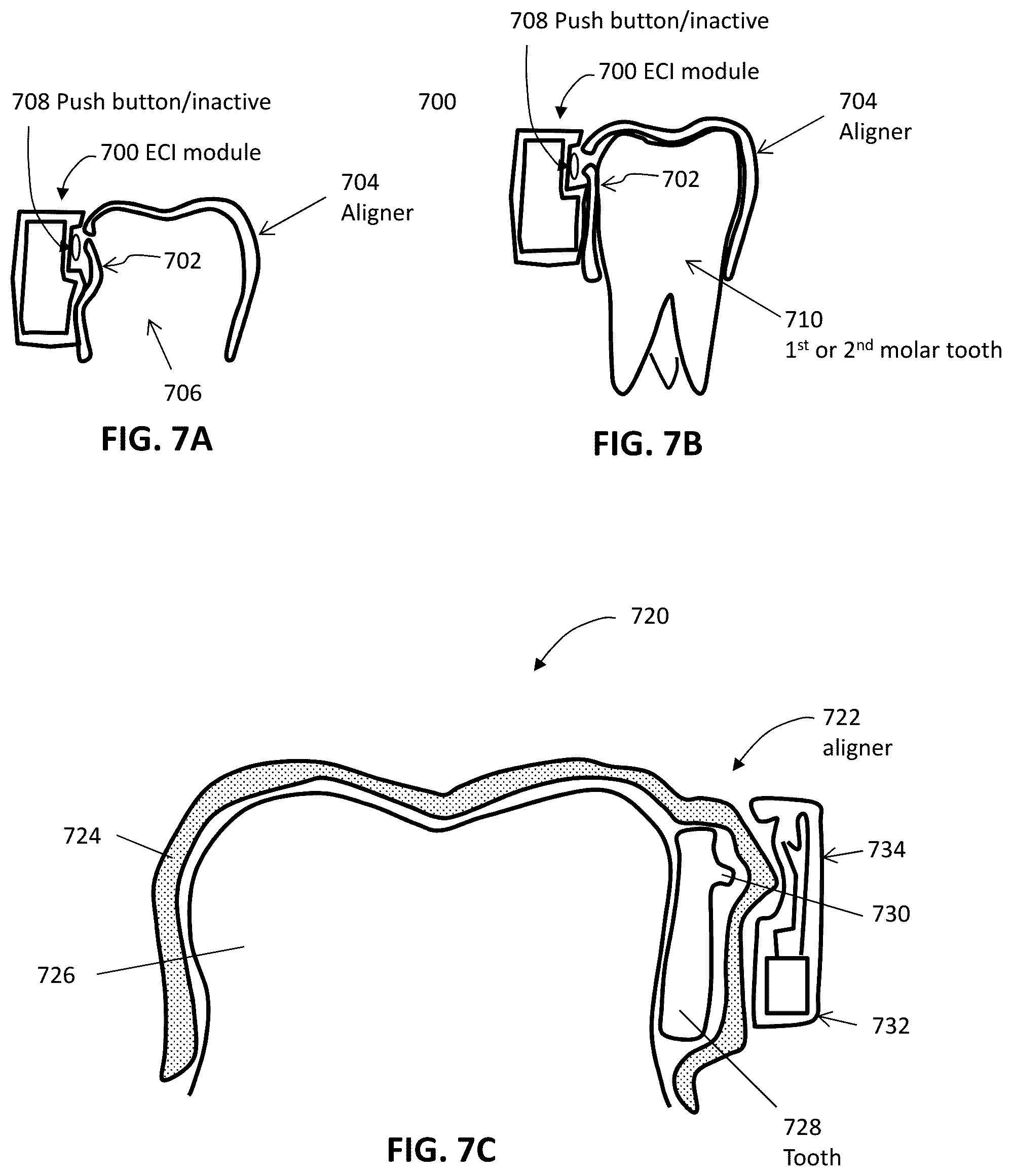 Patent US12508106 Figure 11 – Systems and methods for monitoring orthodontic treatment