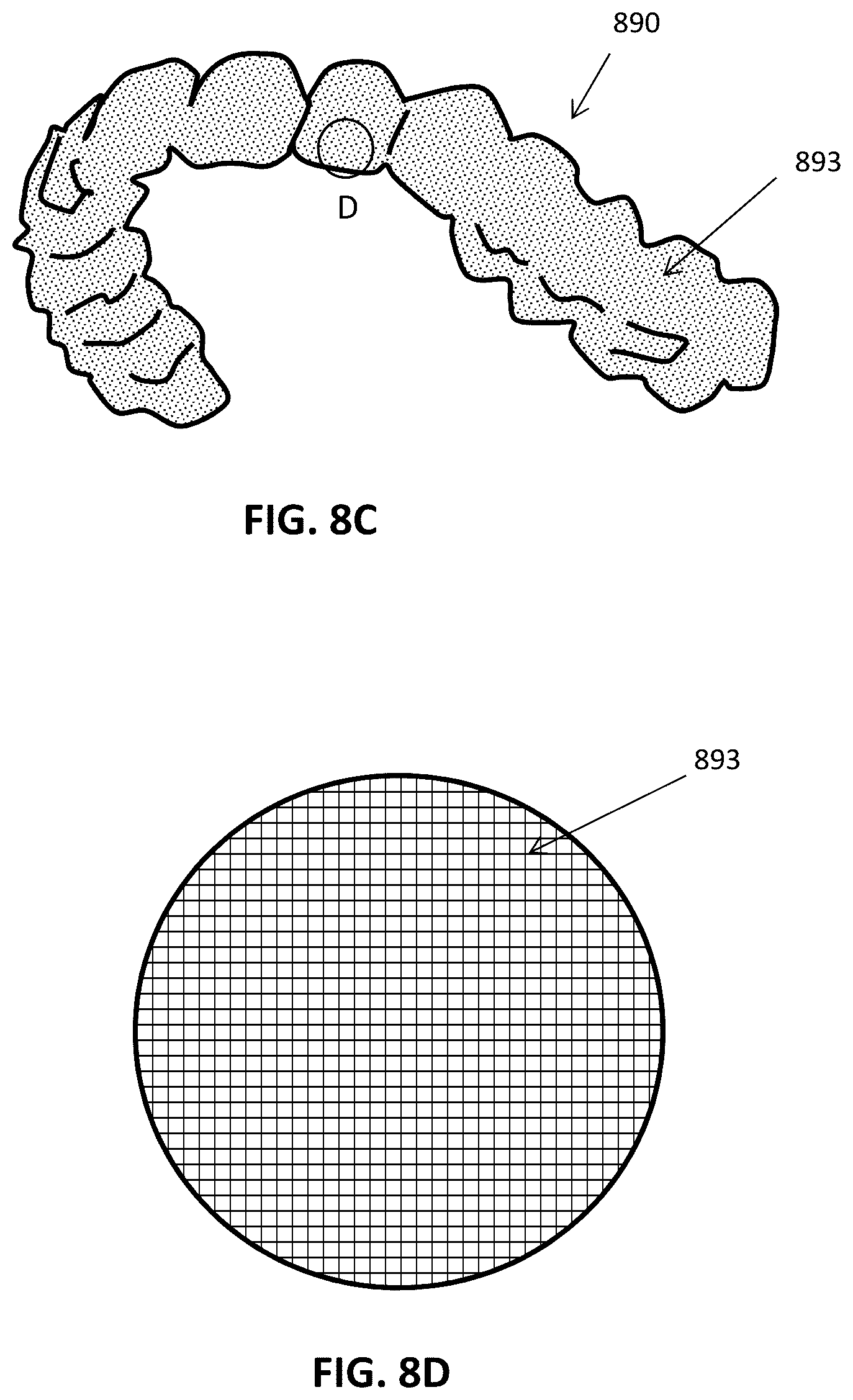 Patent US12508106 Figure 14 – Systems and methods for monitoring orthodontic treatment
