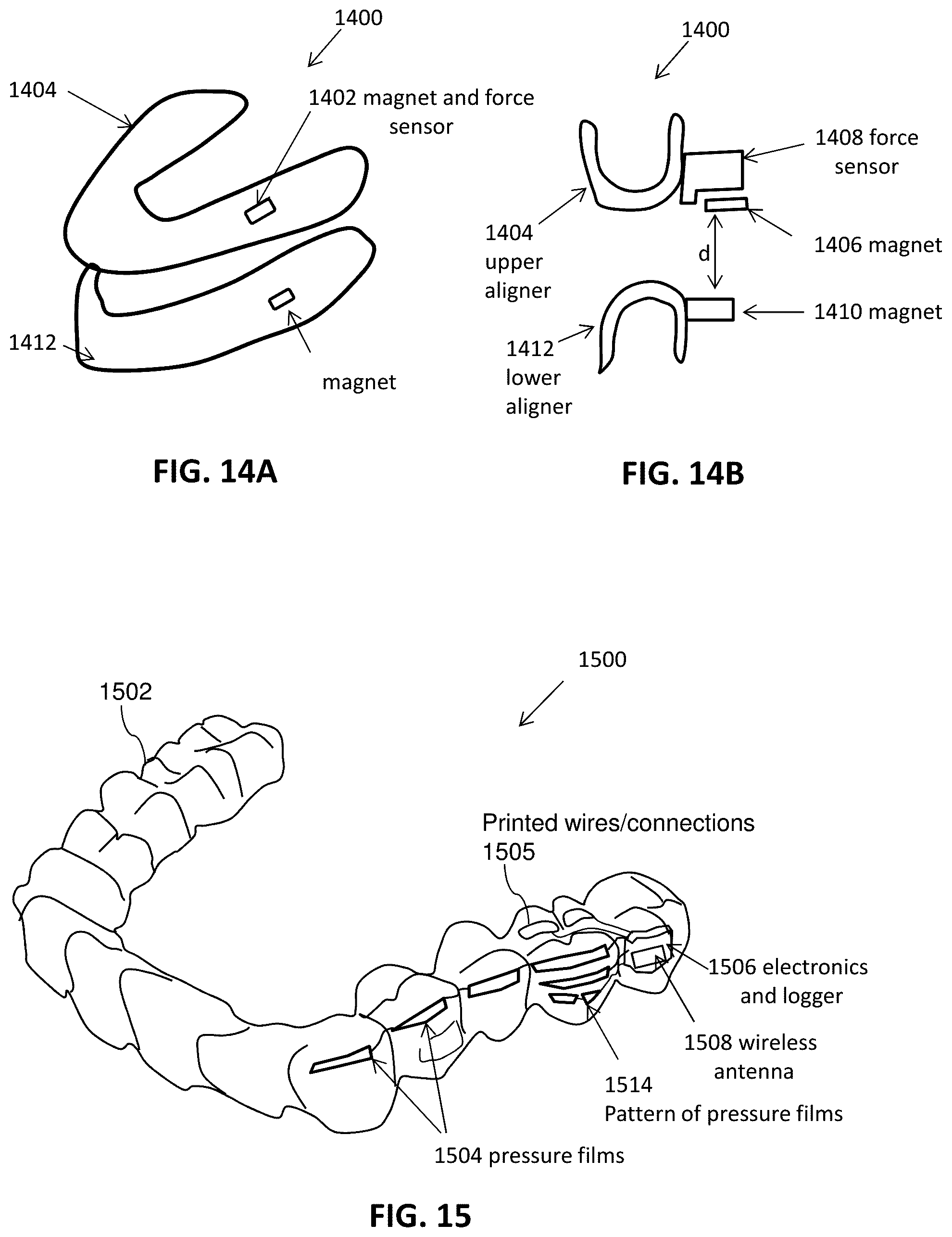 Patent US12508106 Figure 18 – Systems and methods for monitoring orthodontic treatment