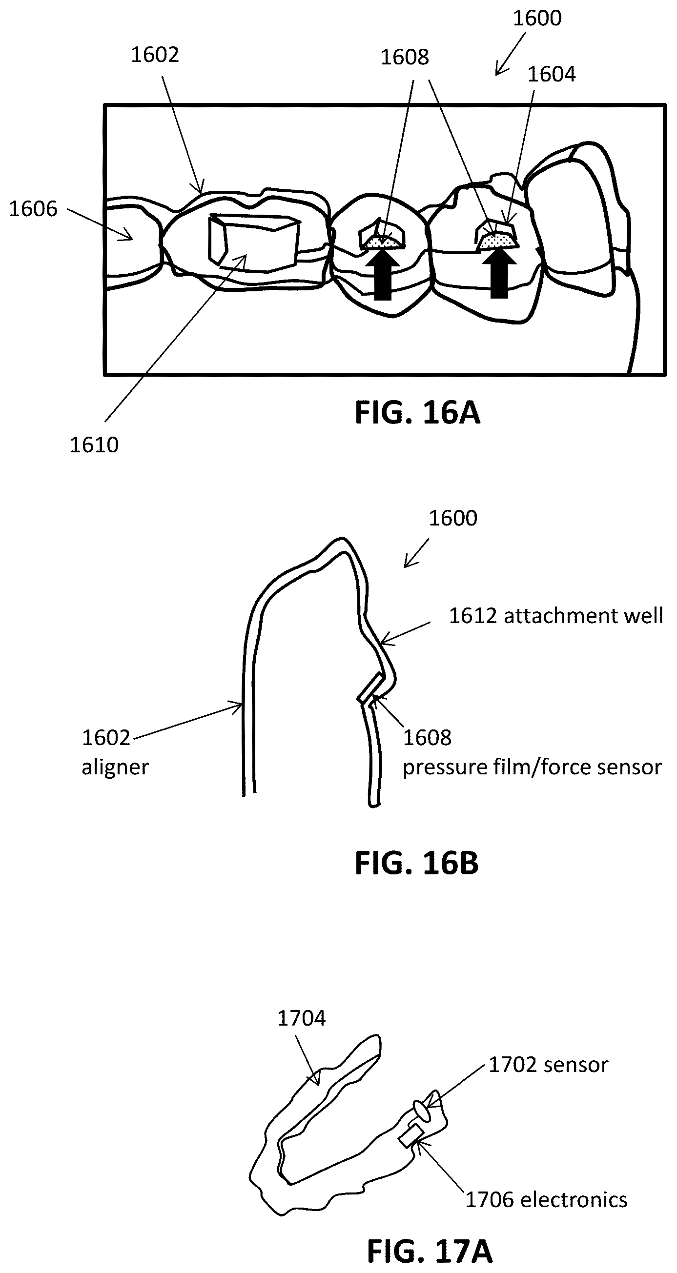 Patent US12508106 Figure 19 – Systems and methods for monitoring orthodontic treatment