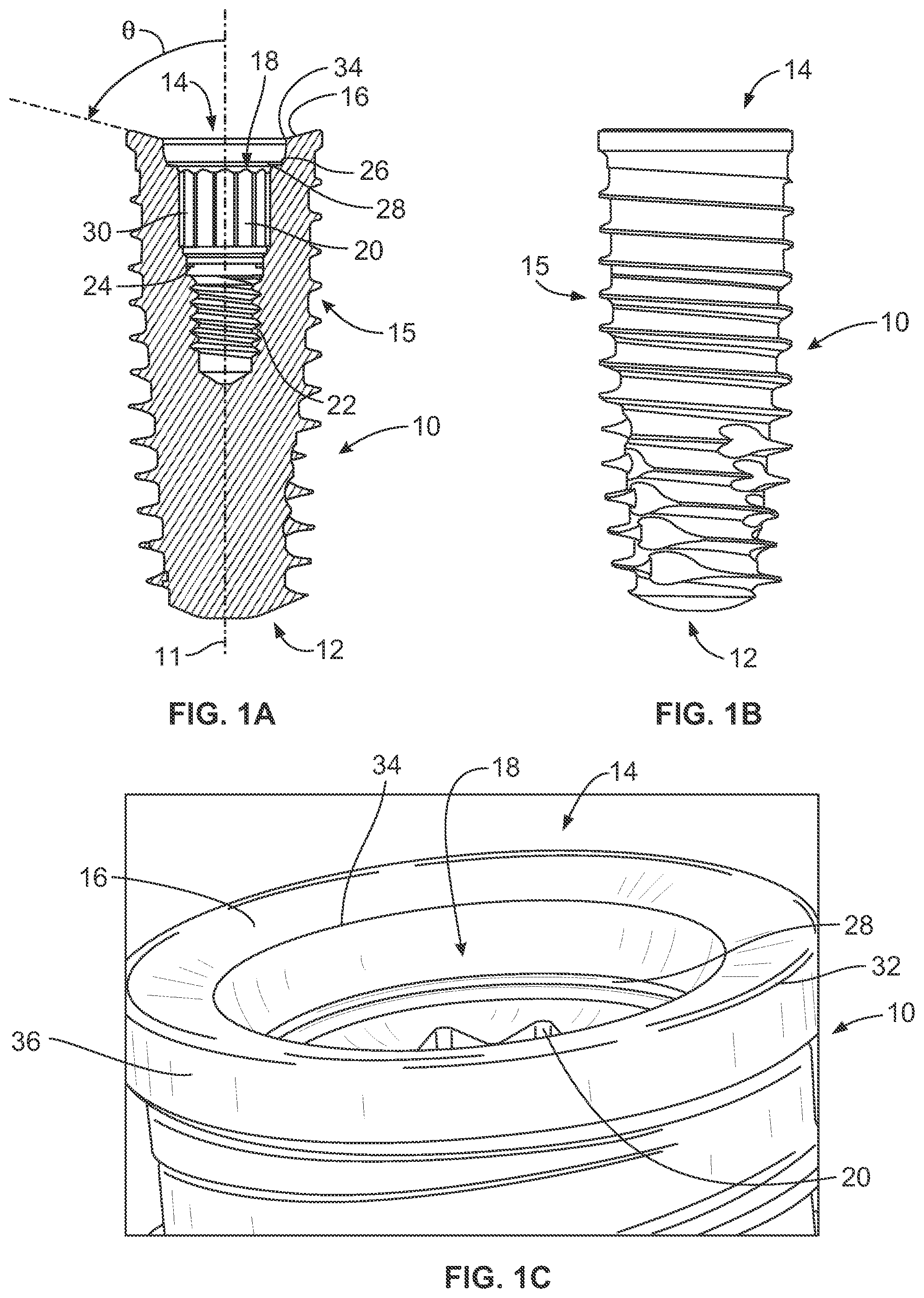 Patent US12508107 Figure 1 – Dental implant system having enhanced soft-tissue growth features
