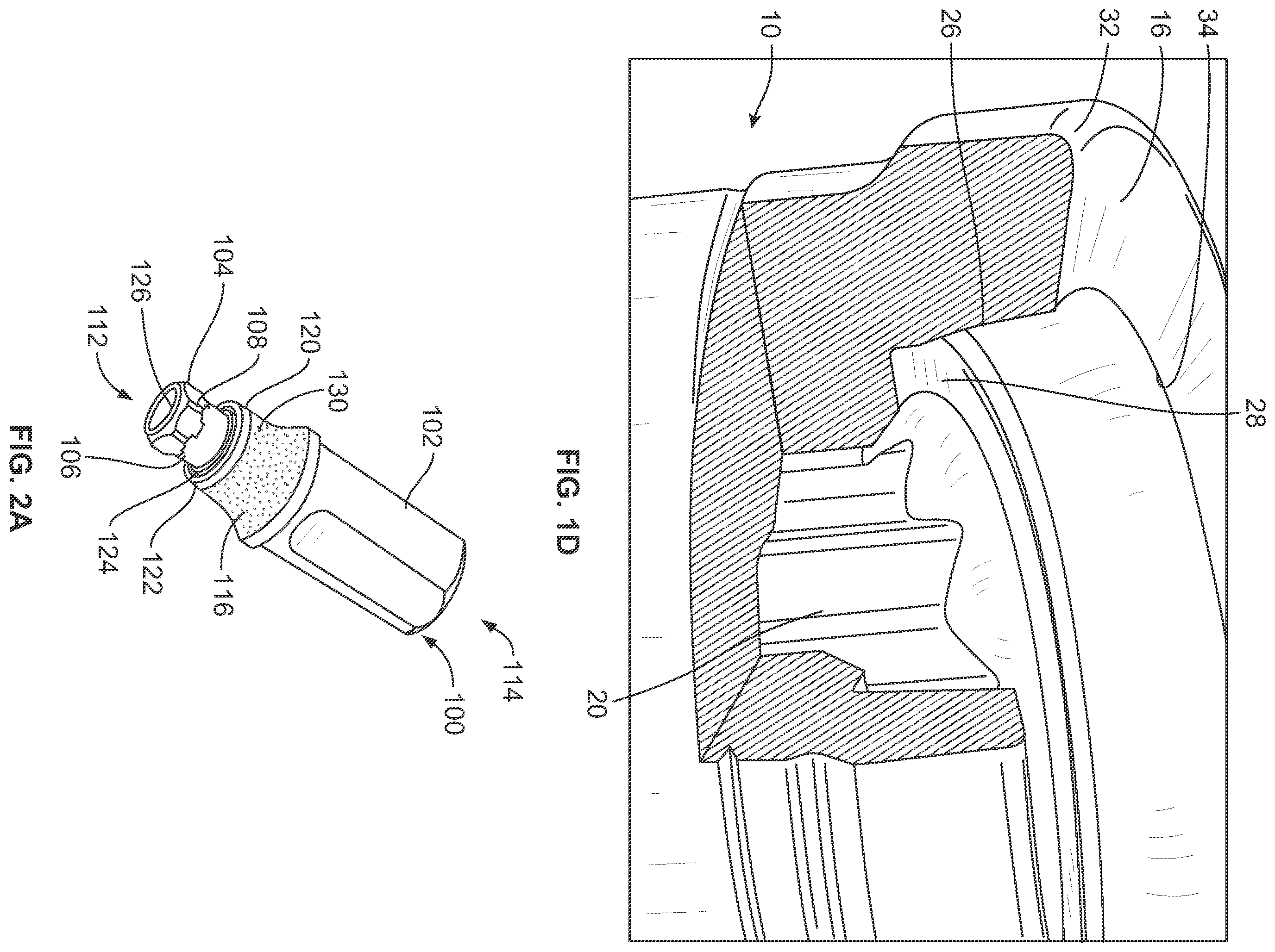 Patent US12508107 Figure 2 – Dental implant system having enhanced soft-tissue growth features