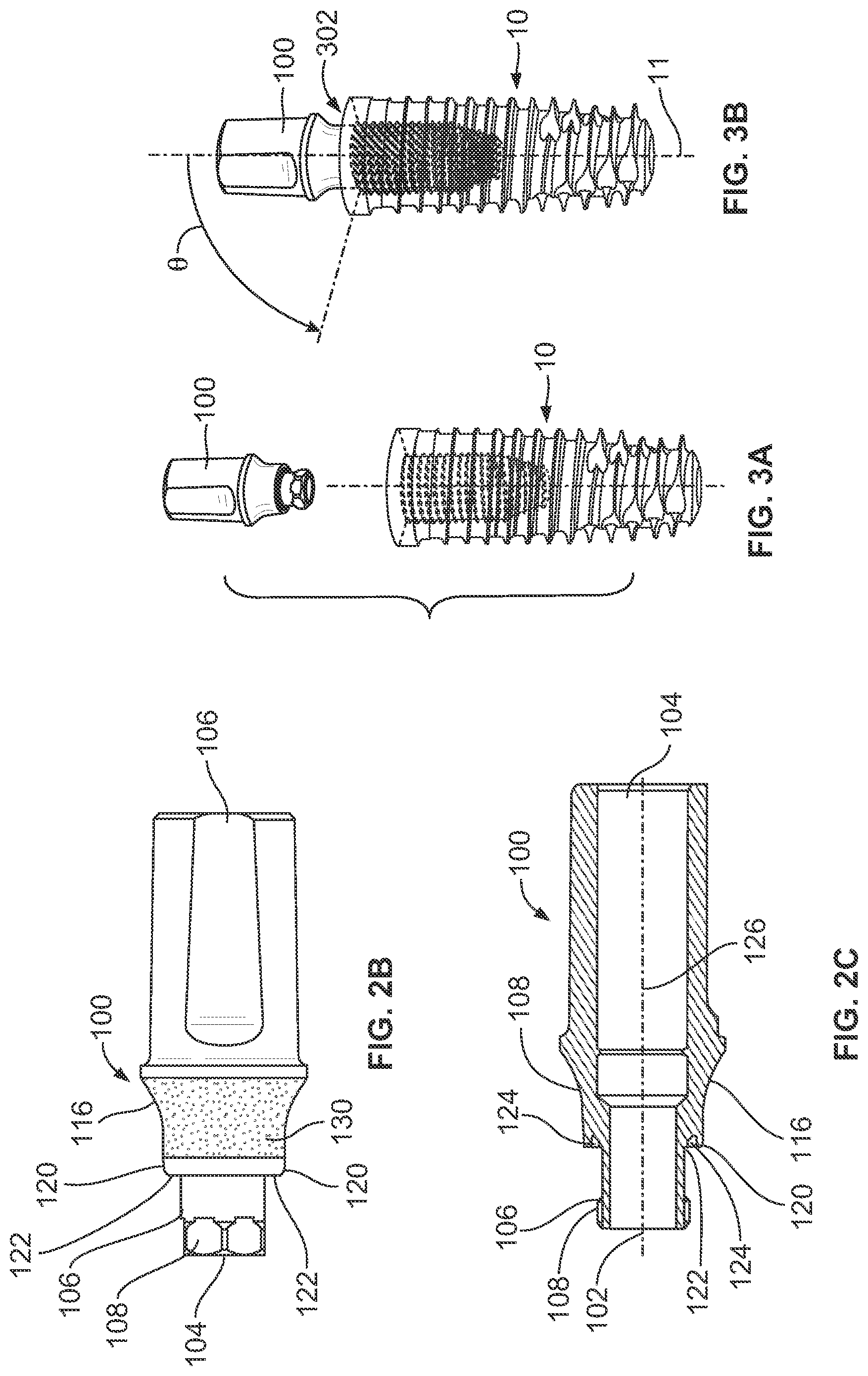 Patent US12508107 Figure 3 – Dental implant system having enhanced soft-tissue growth features