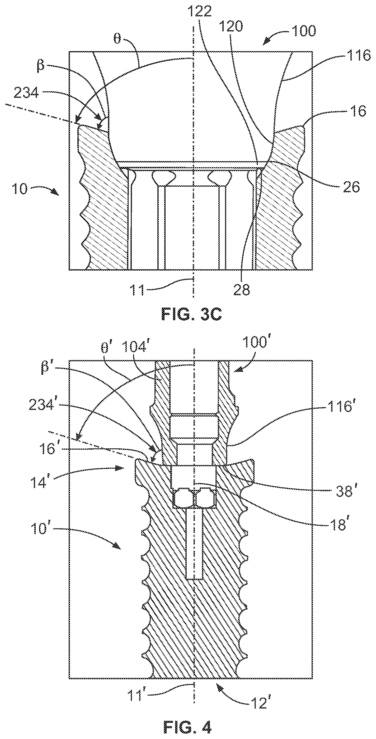 Patent US12508107 Figure 4 – Dental implant system having enhanced soft-tissue growth features