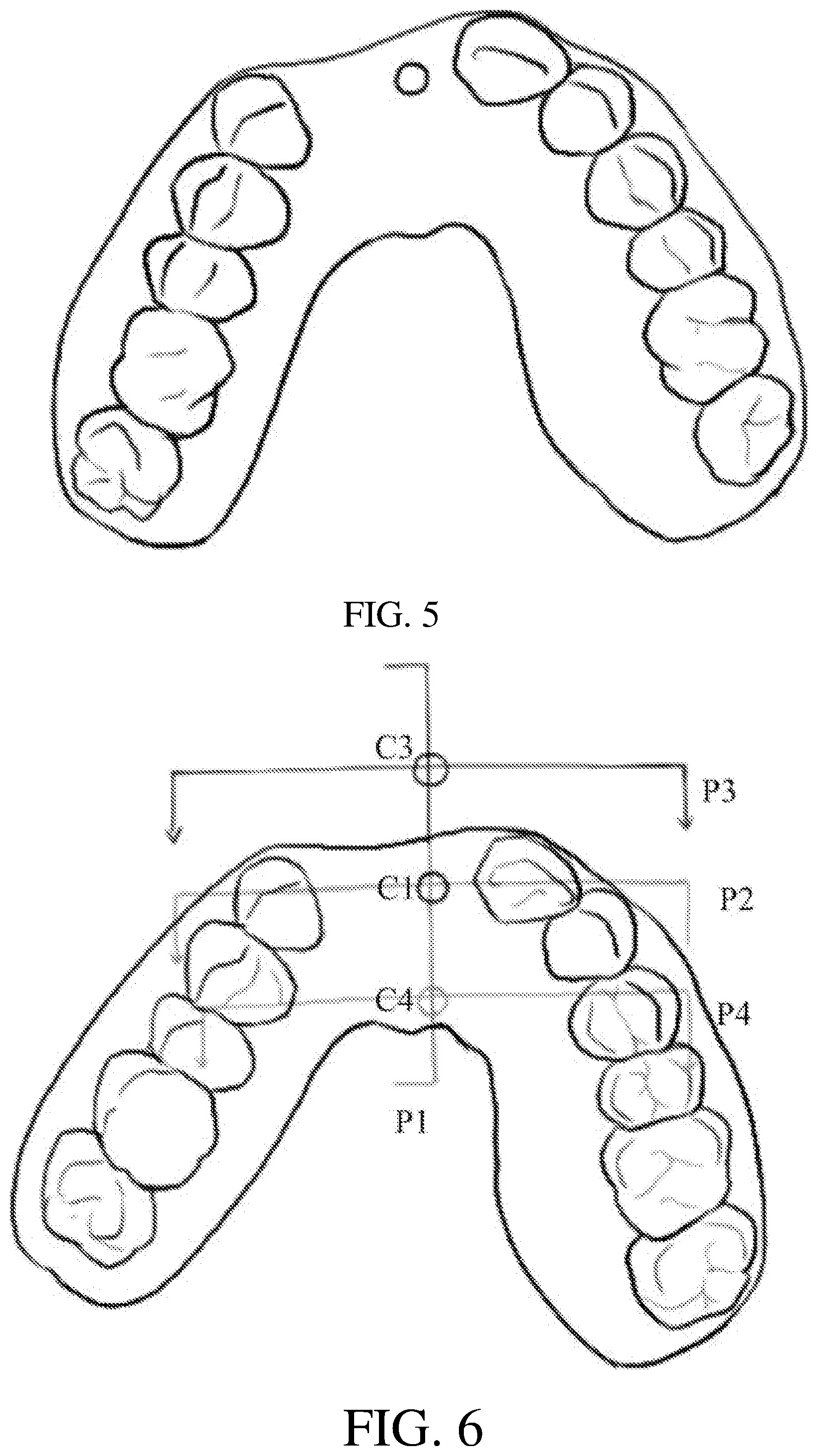 Patent US12508108 Figure 3 – Axial direction and depth checking guide plate for implanting and manufacture method thereof