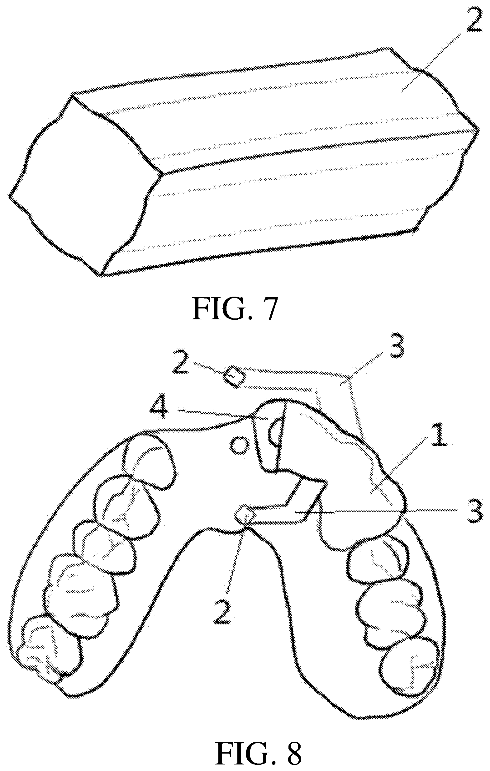 Patent US12508108 Figure 4 – Axial direction and depth checking guide plate for implanting and manufacture method thereof