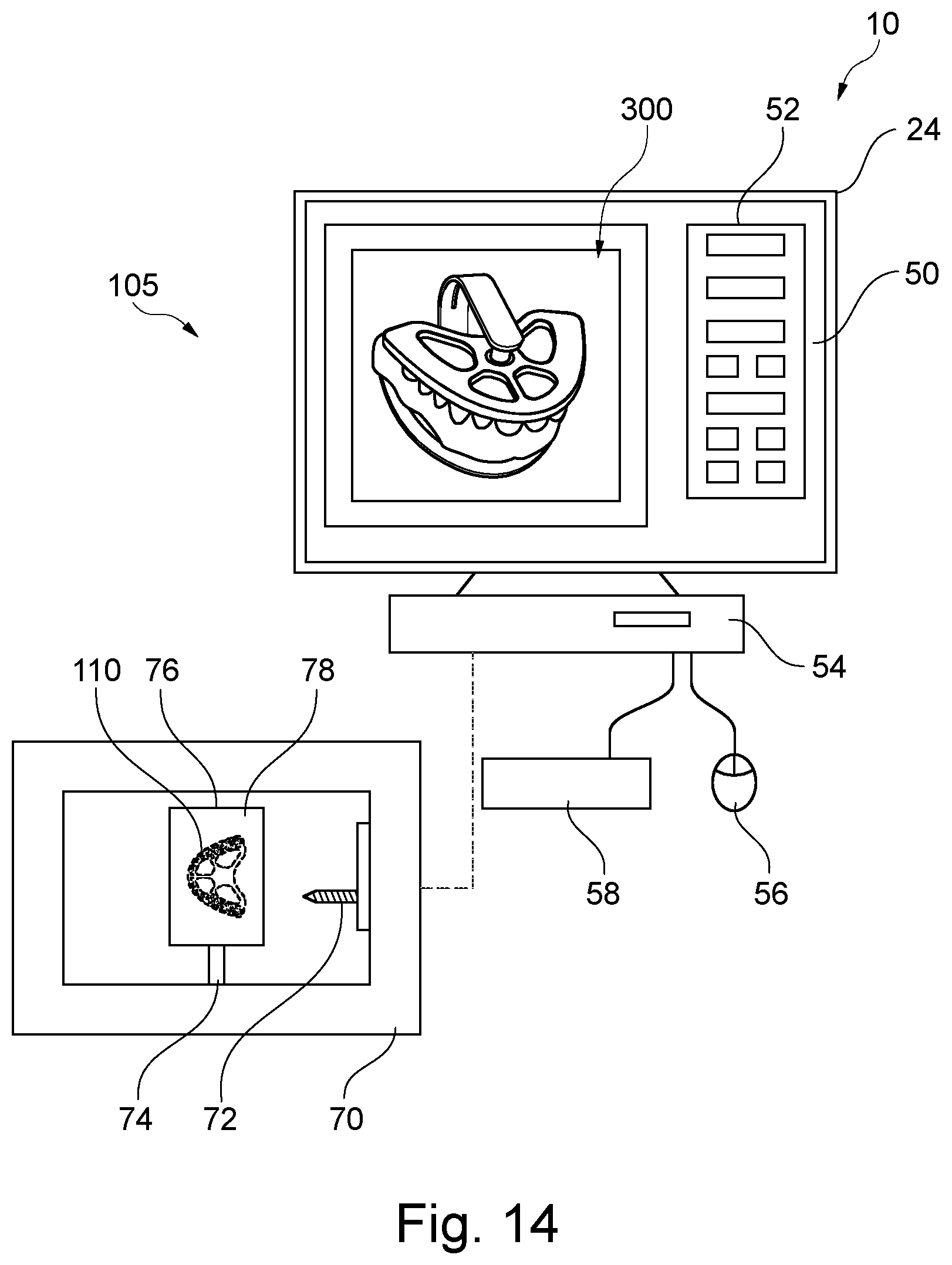 Patent US12508109 Figure 15 – Bonding auxiliary device for artificial teeth
