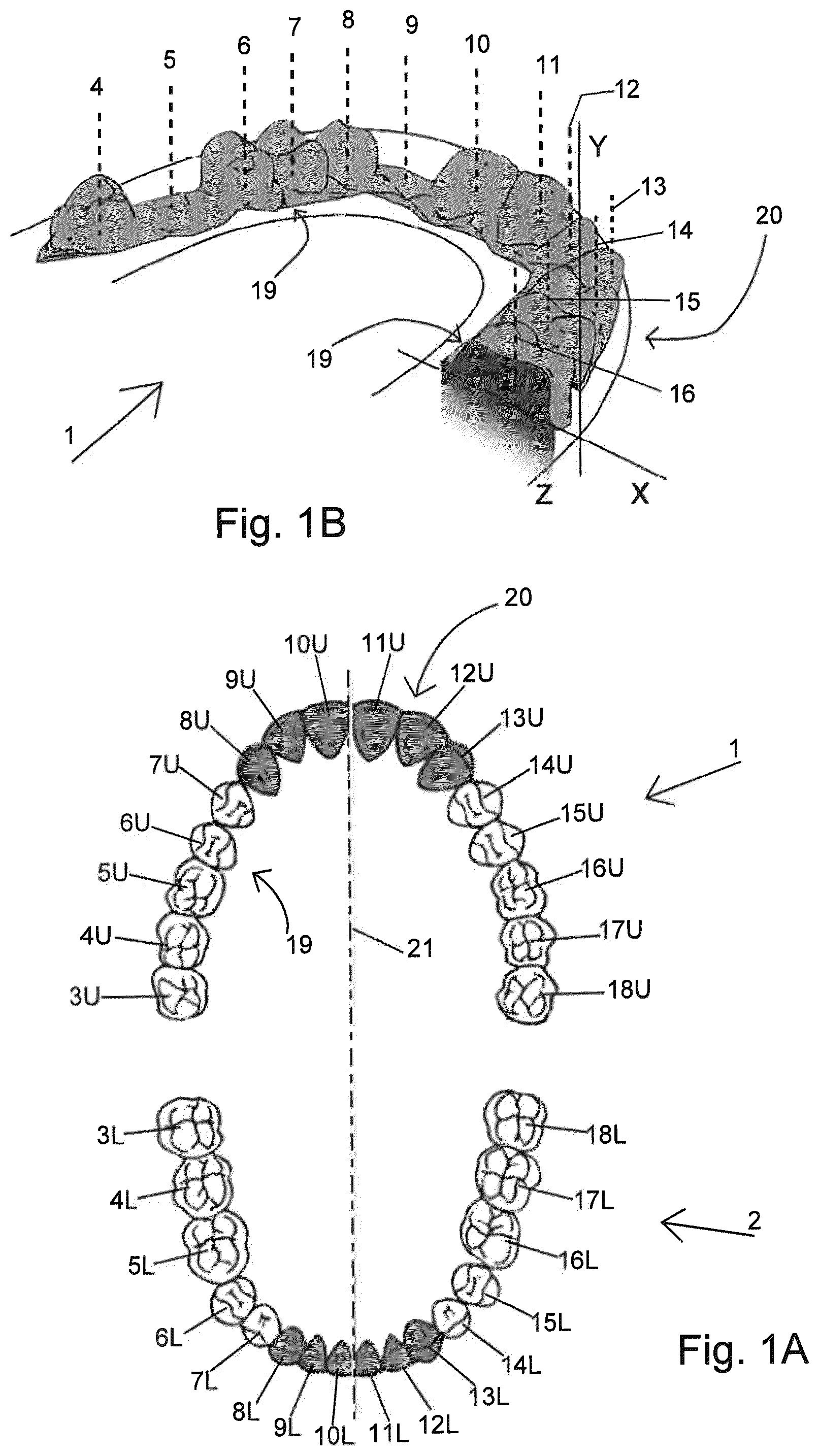 Patent US12508113 — Method of manufacturing a pressure chamber of a dental mouthpiece, method of manufacturing a dental mouthpiece, pressure chamber and mouthpiece manufactured with these methods, provided with these methods, J-/U-shaped dental mouthpiece, and systems comprising said mouthpieces — Figure 1