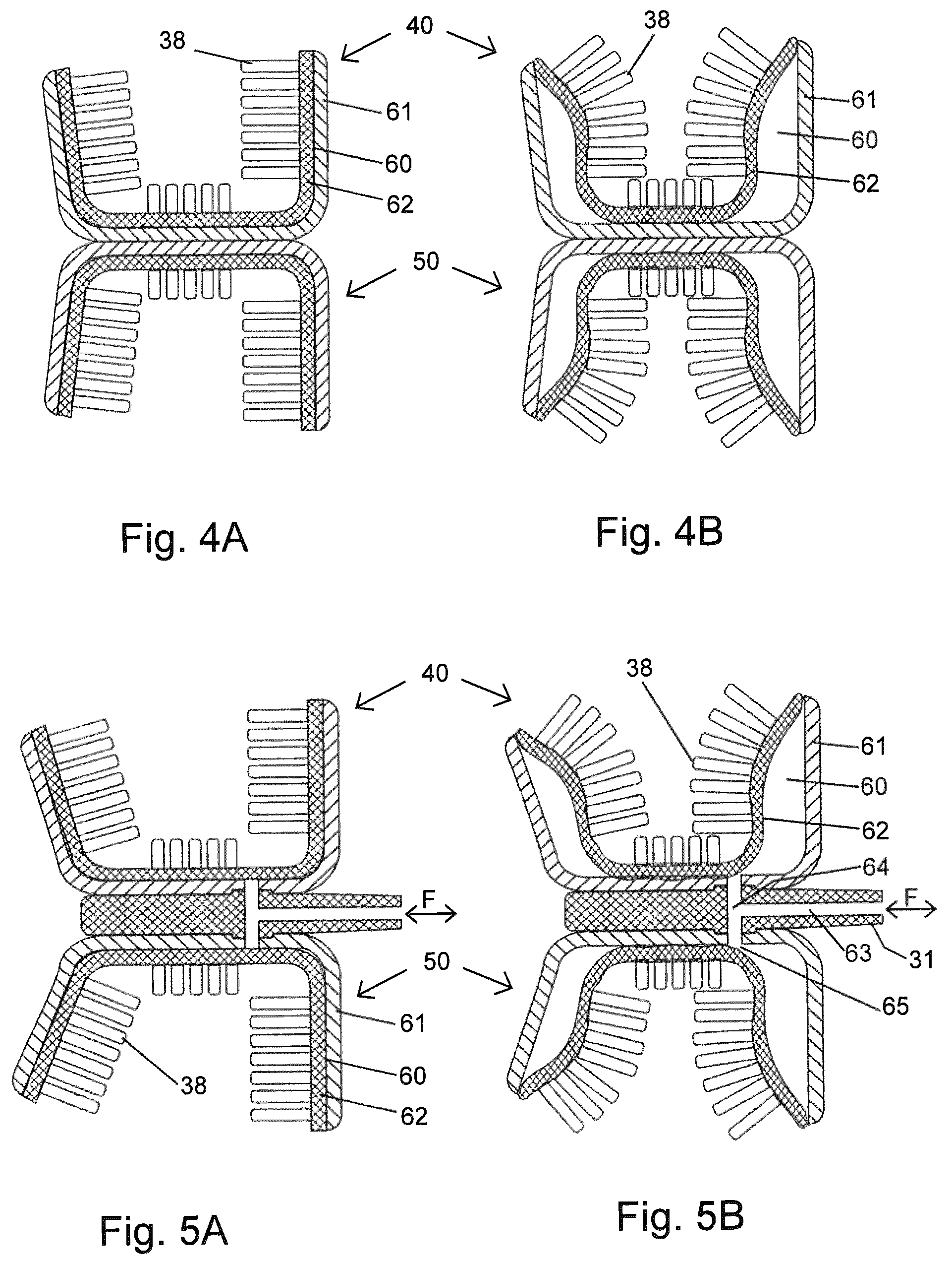 Patent US12508113 Figure 3 – Method of manufacturing a pressure chamber of a dental mouthpiece, method of manufacturing a dental mouthpiece, pressure chamber and mouthpiece manufactured with these methods, provided with these methods, J-/U-shaped dental mouthpiece, and systems comprising said mouthpieces