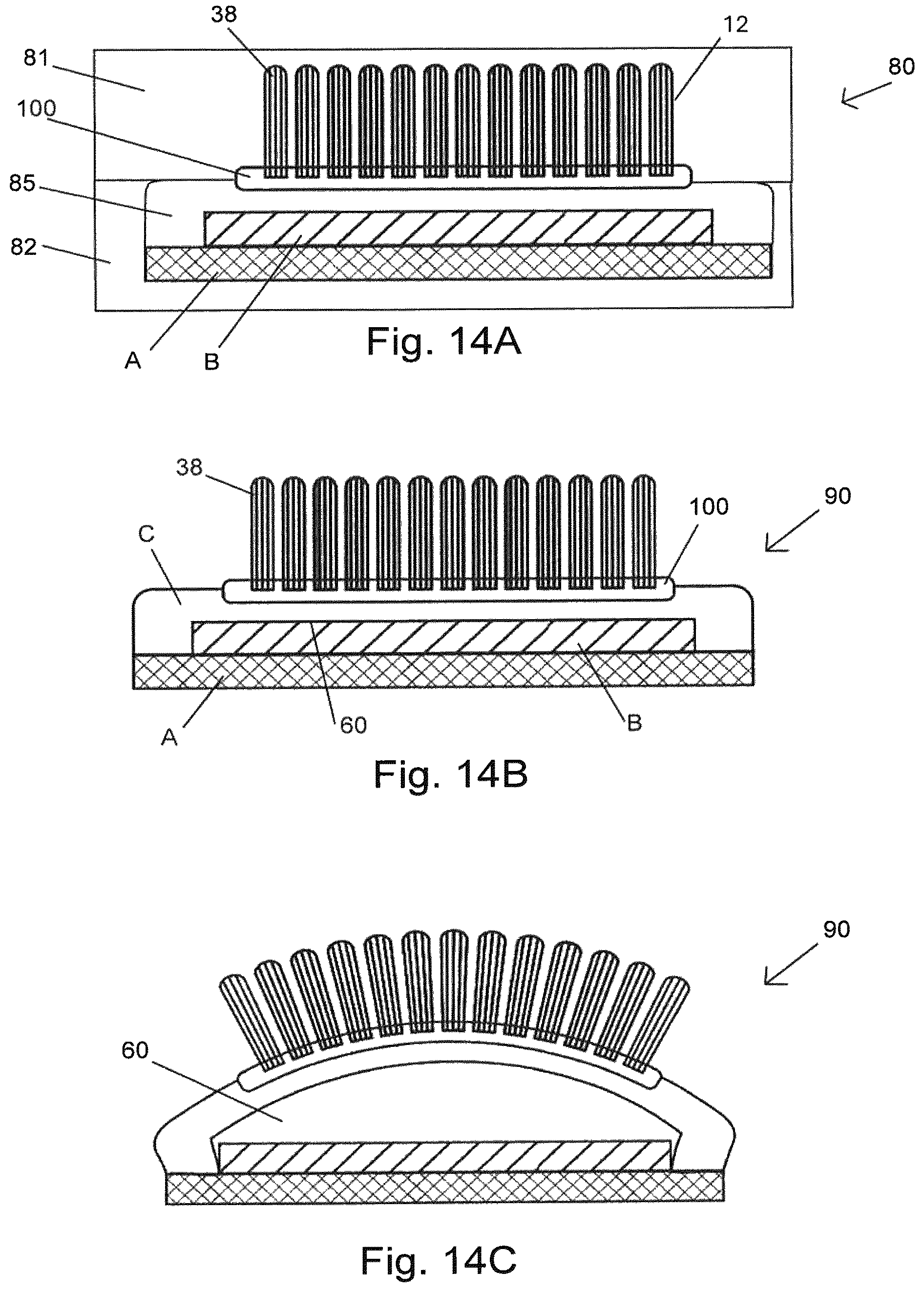 Patent US12508113 Figure 10 – Method of manufacturing a pressure chamber of a dental mouthpiece, method of manufacturing a dental mouthpiece, pressure chamber and mouthpiece manufactured with these methods, provided with these methods, J-/U-shaped dental mouthpiece, and systems comprising said mouthpieces
