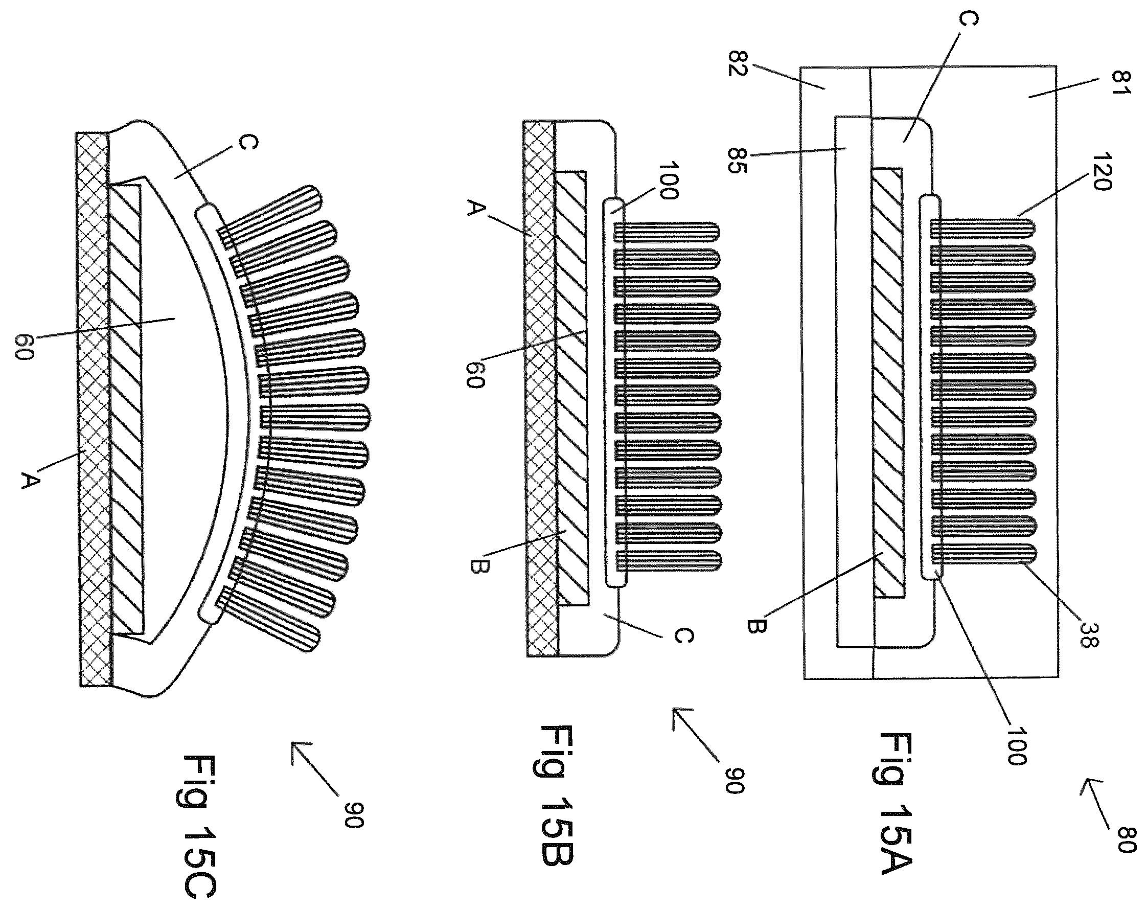 Patent US12508113 Figure 11 – Method of manufacturing a pressure chamber of a dental mouthpiece, method of manufacturing a dental mouthpiece, pressure chamber and mouthpiece manufactured with these methods, provided with these methods, J-/U-shaped dental mouthpiece, and systems comprising said mouthpieces