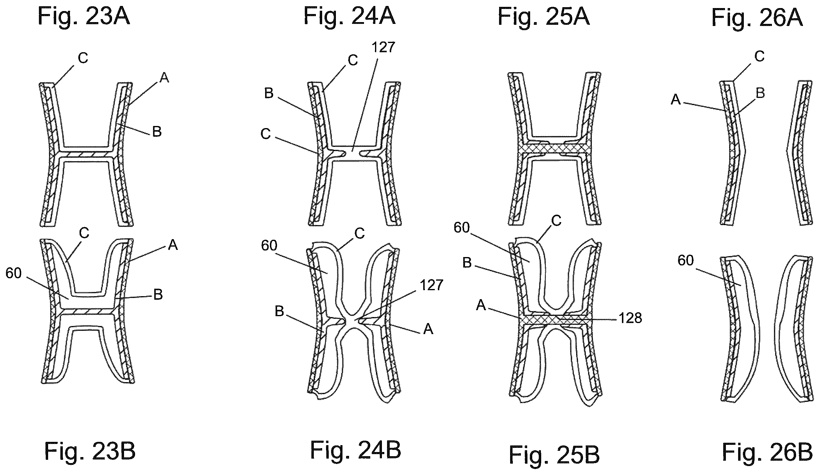 Patent US12508113 Figure 15 – Method of manufacturing a pressure chamber of a dental mouthpiece, method of manufacturing a dental mouthpiece, pressure chamber and mouthpiece manufactured with these methods, provided with these methods, J-/U-shaped dental mouthpiece, and systems comprising said mouthpieces