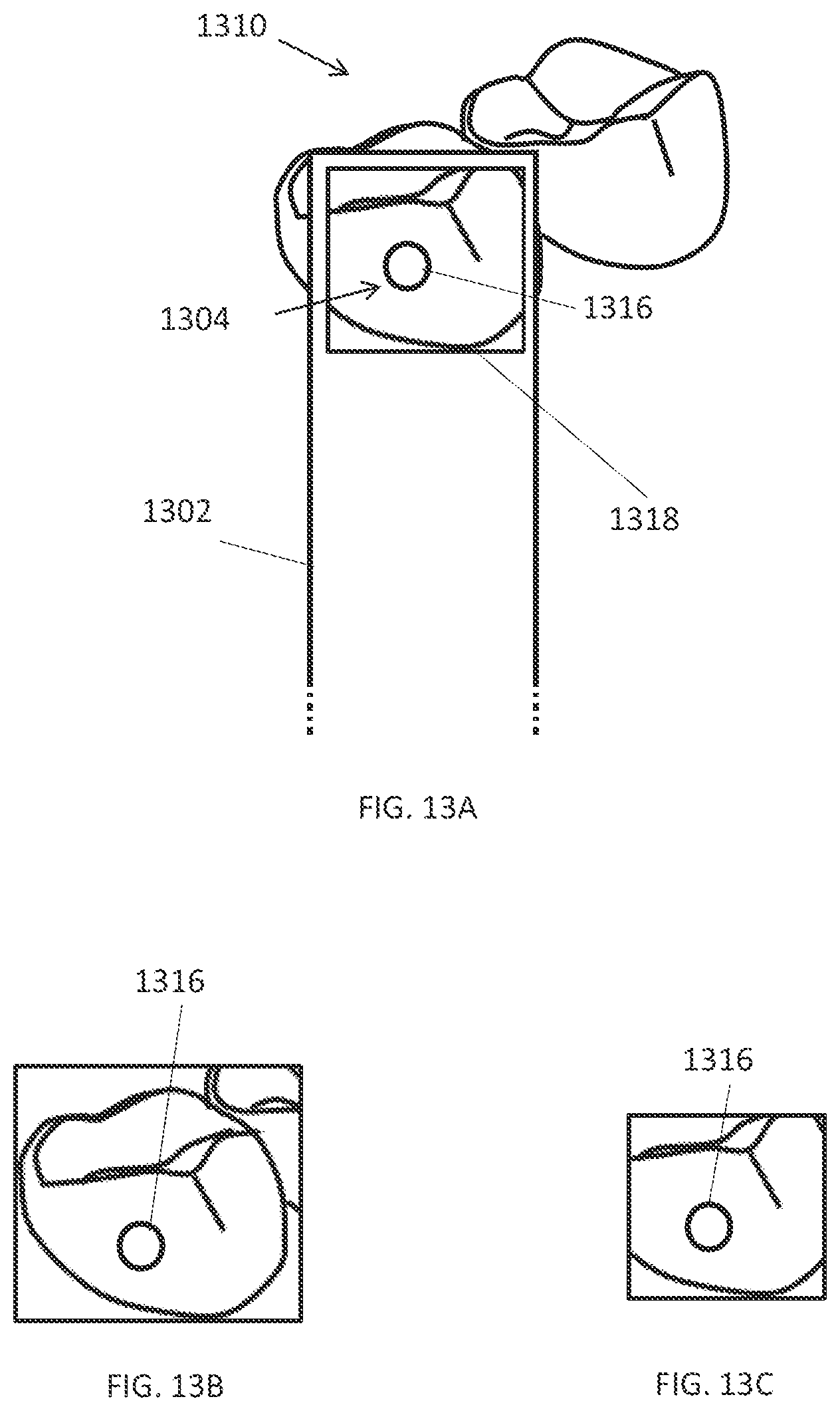 Patent US12508114 Figure 12 – User interface for a dental measurement system