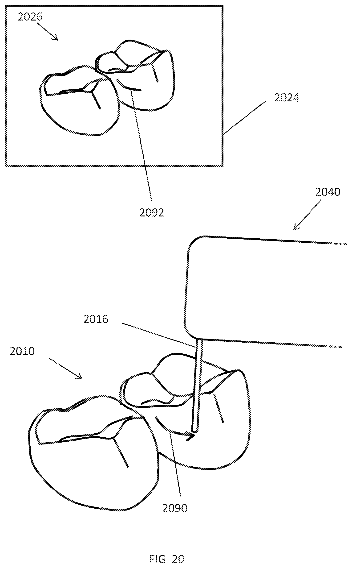 Patent US12508114 Figure 19 – User interface for a dental measurement system