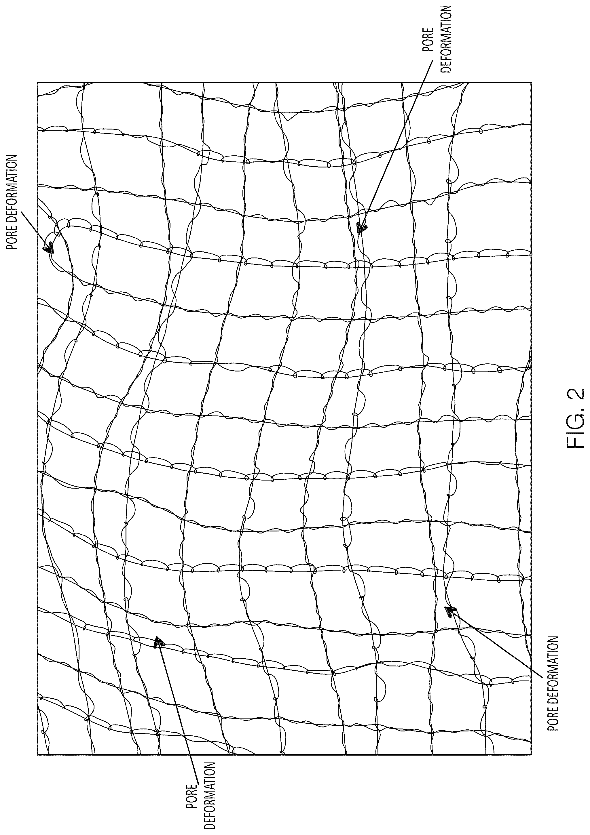 Patent US12508116 Figure 2 – Implants with corner-lock stitch patterns
