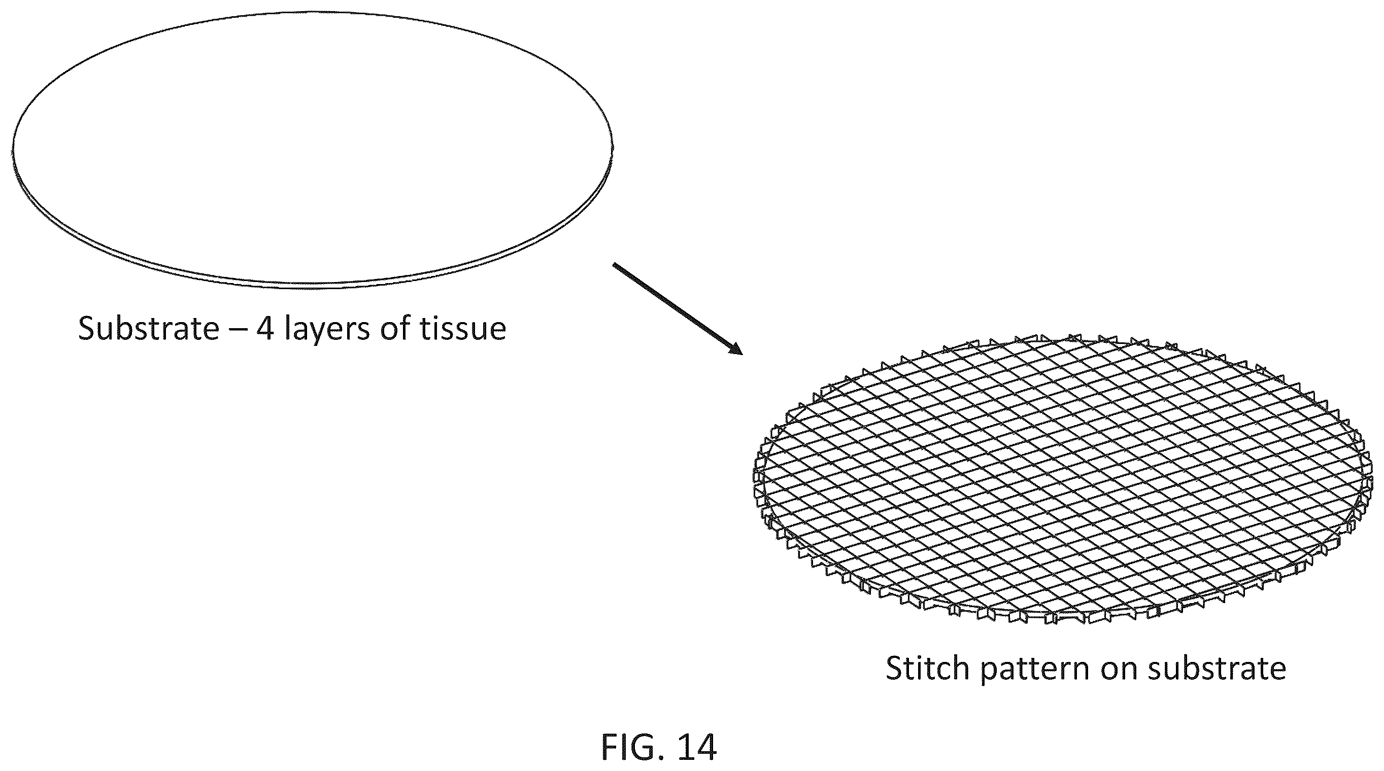 Patent US12508116 Figure 17 – Implants with corner-lock stitch patterns