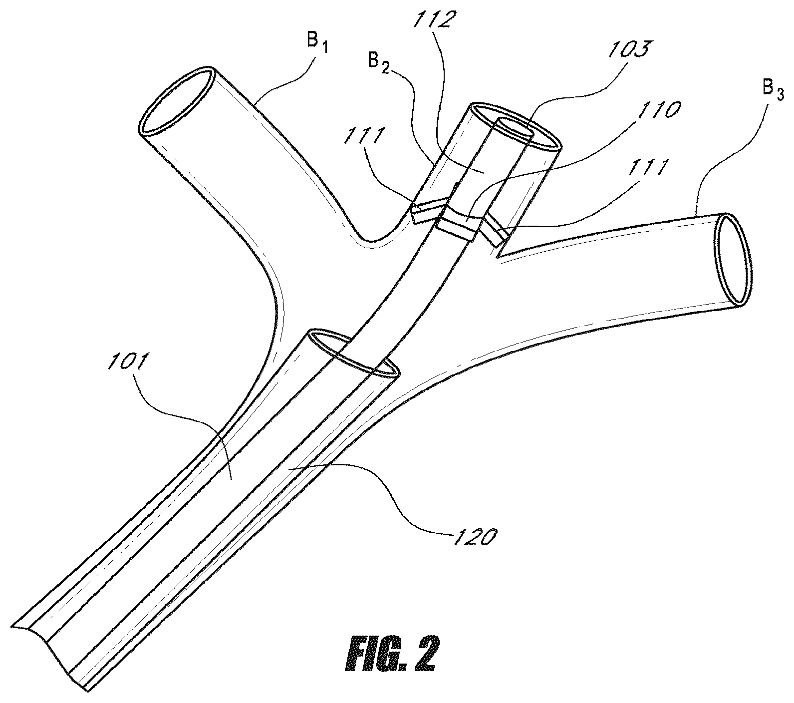 Patent US12508117 Figure 2 – Devices and systems for lung treatment