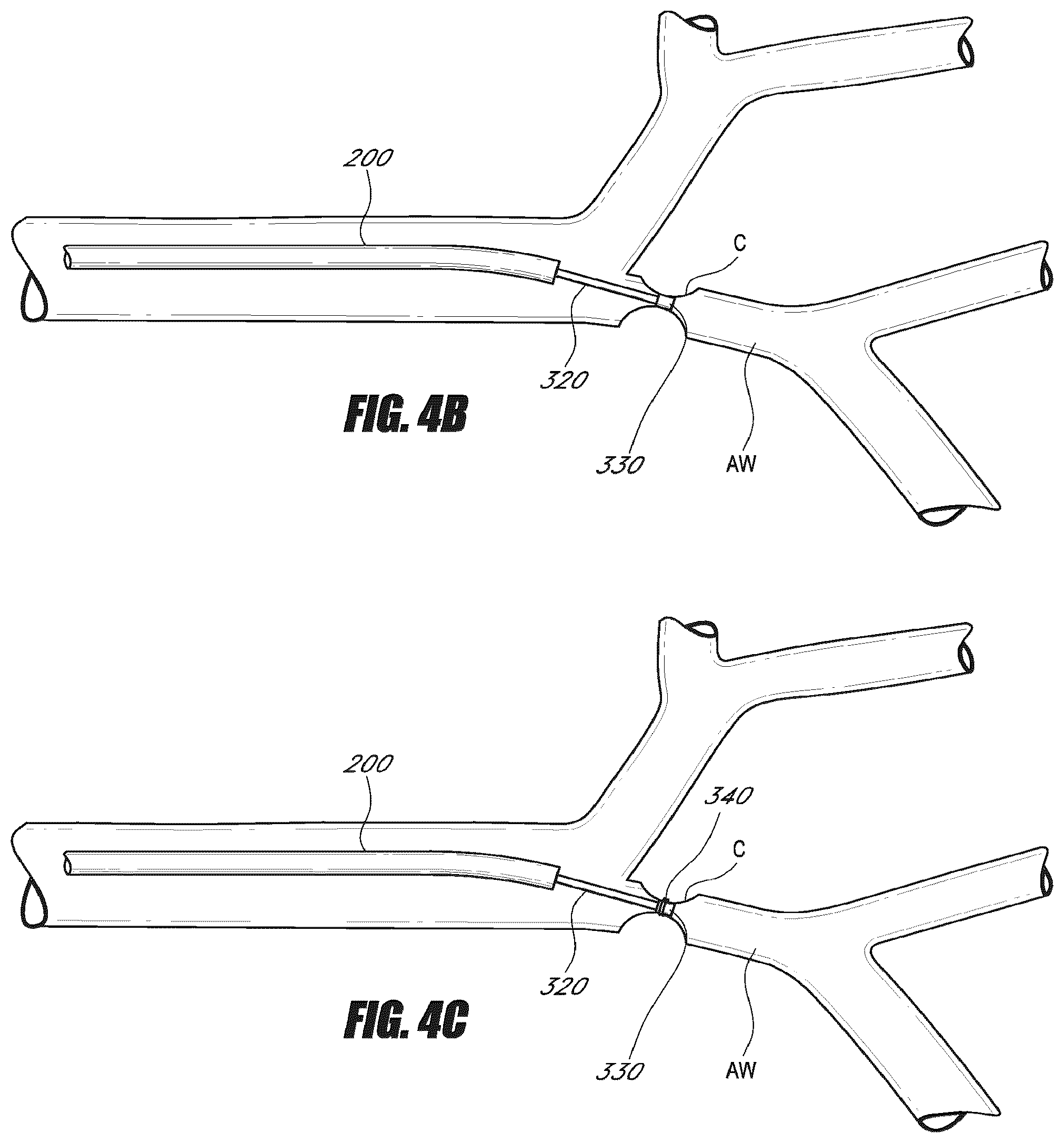 Patent US12508117 Figure 4 – Devices and systems for lung treatment