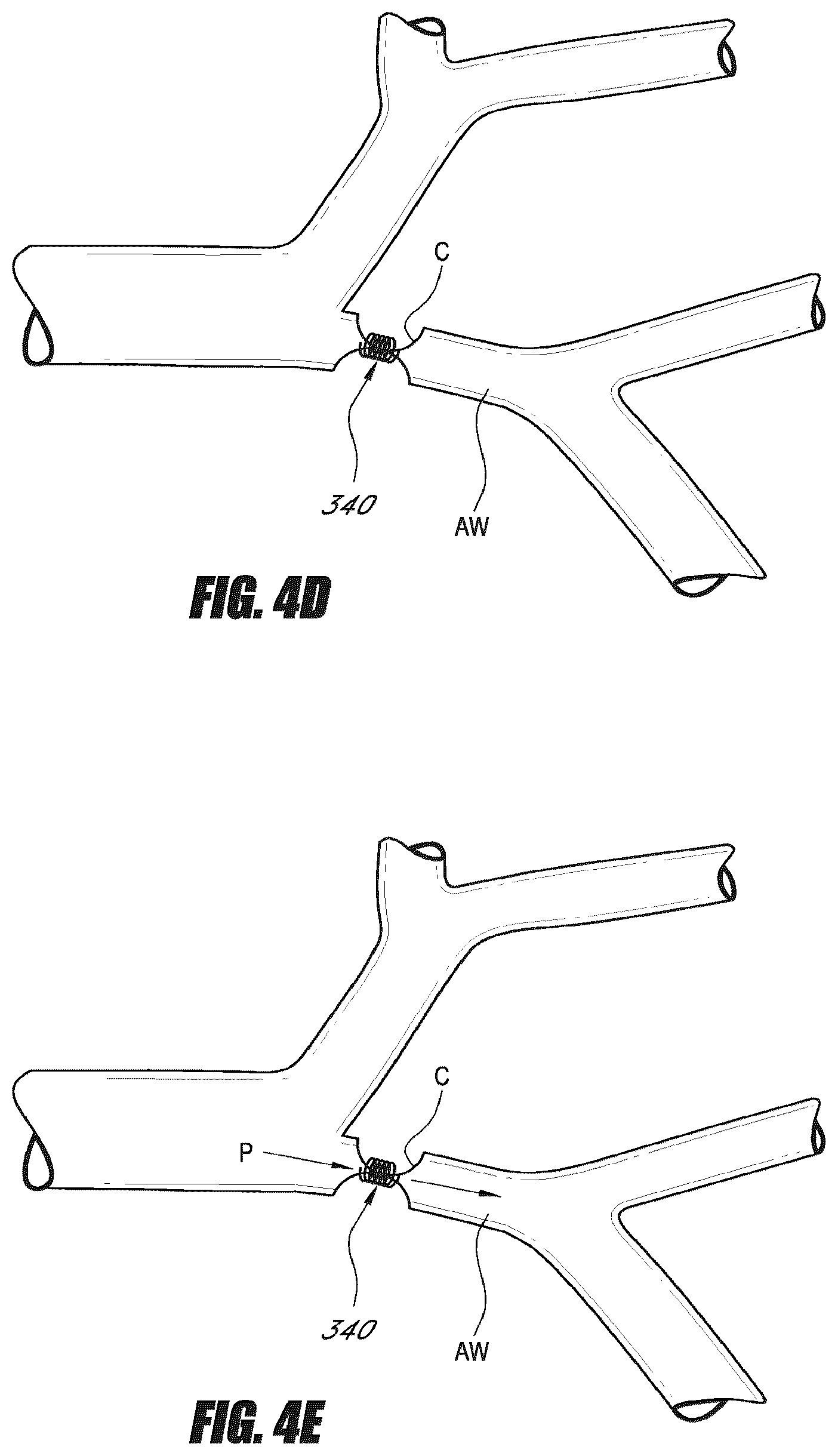 Patent US12508117 Figure 5 – Devices and systems for lung treatment