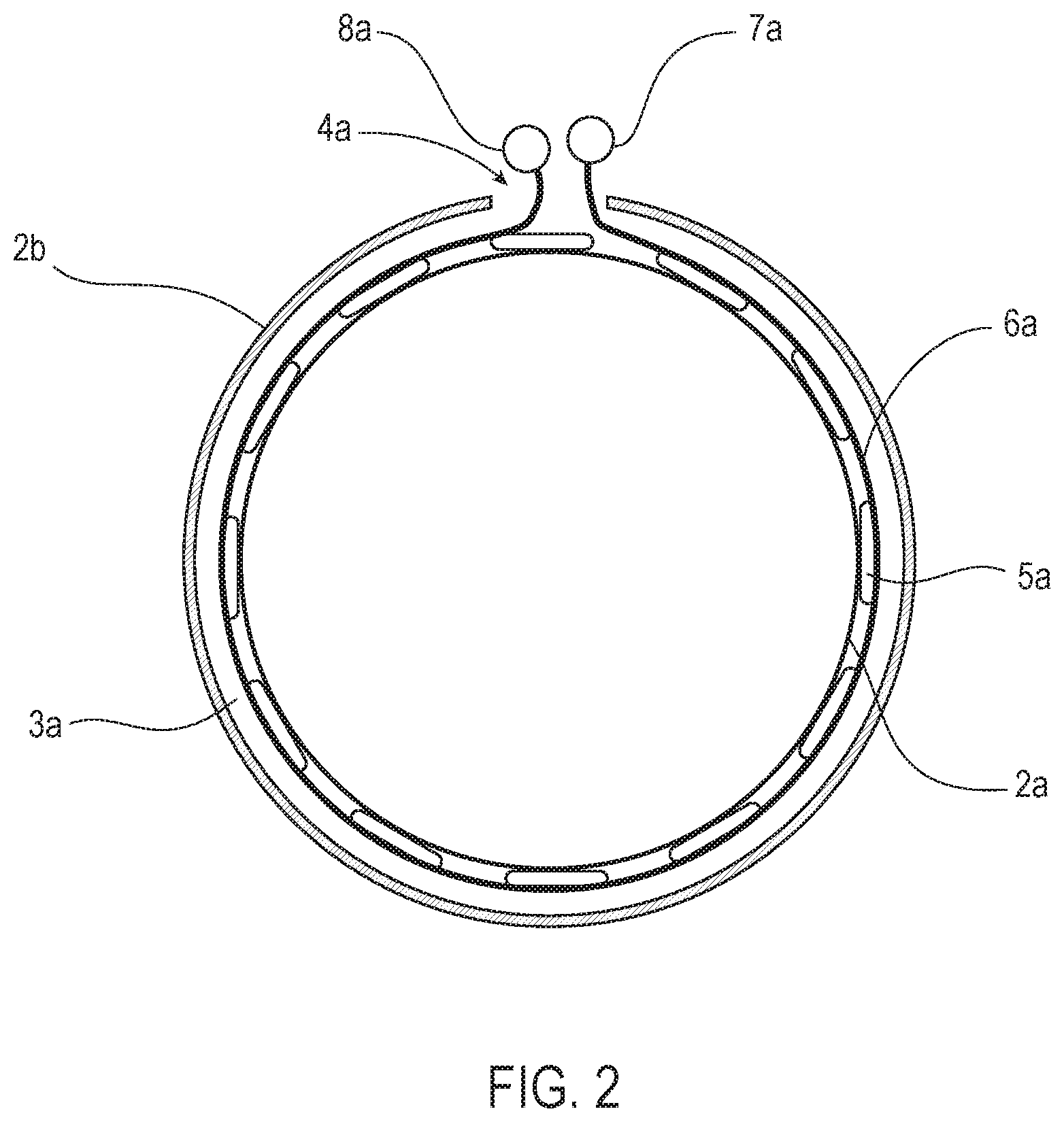 Patent US12508118 Figure 2 – Stent graft systems with restraints in channels and methods thereof
