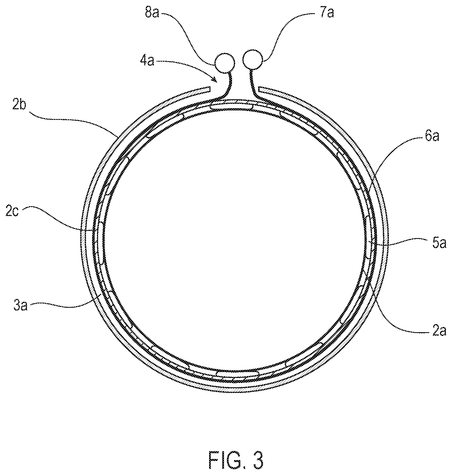 Patent US12508118 Figure 3 – Stent graft systems with restraints in channels and methods thereof