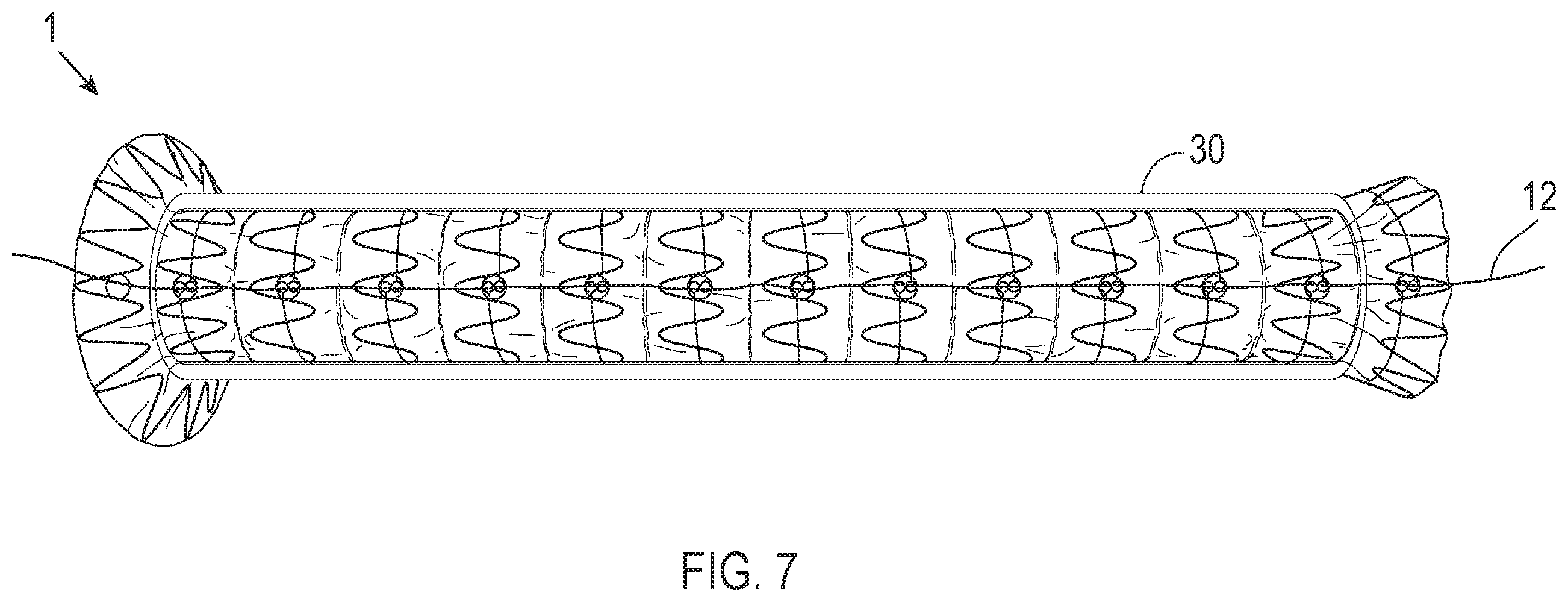 Patent US12508118 Figure 7 – Stent graft systems with restraints in channels and methods thereof