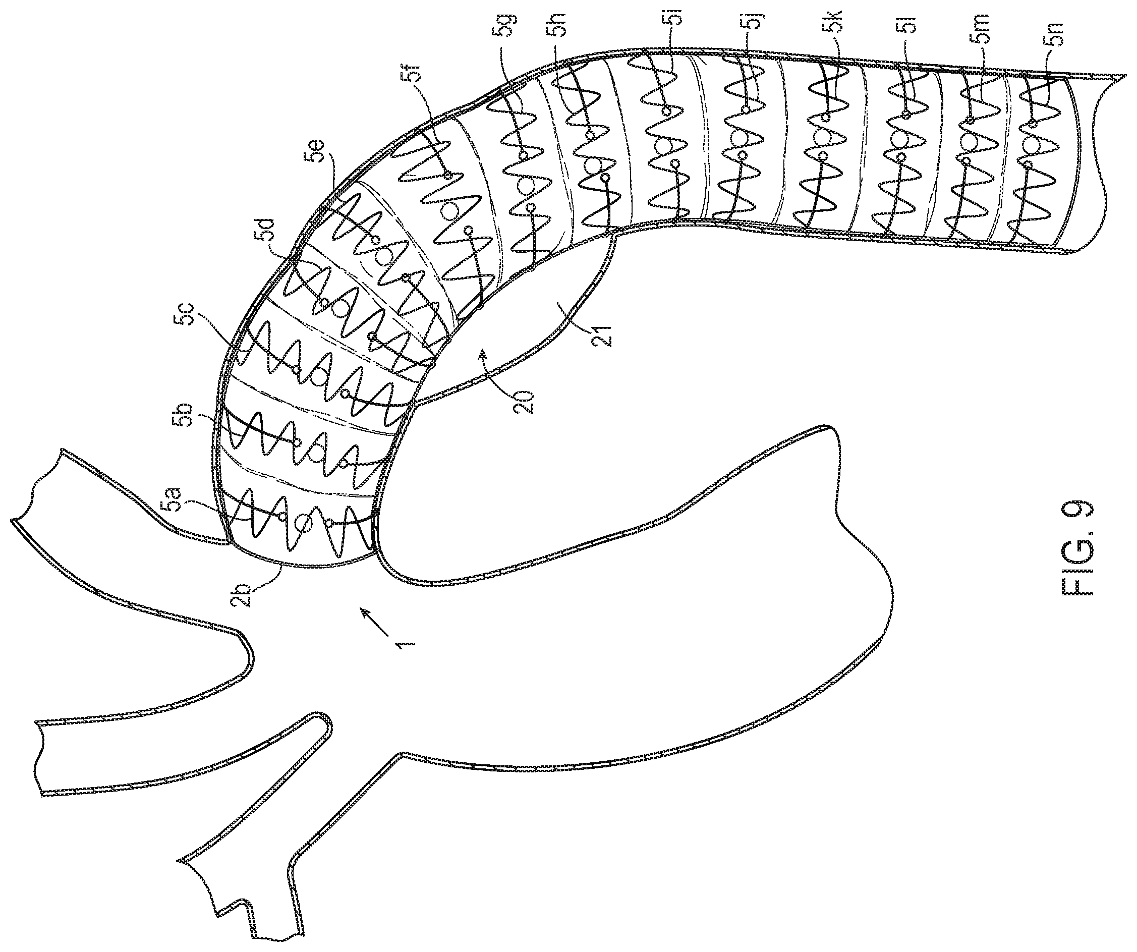 Patent US12508118 Figure 9 – Stent graft systems with restraints in channels and methods thereof