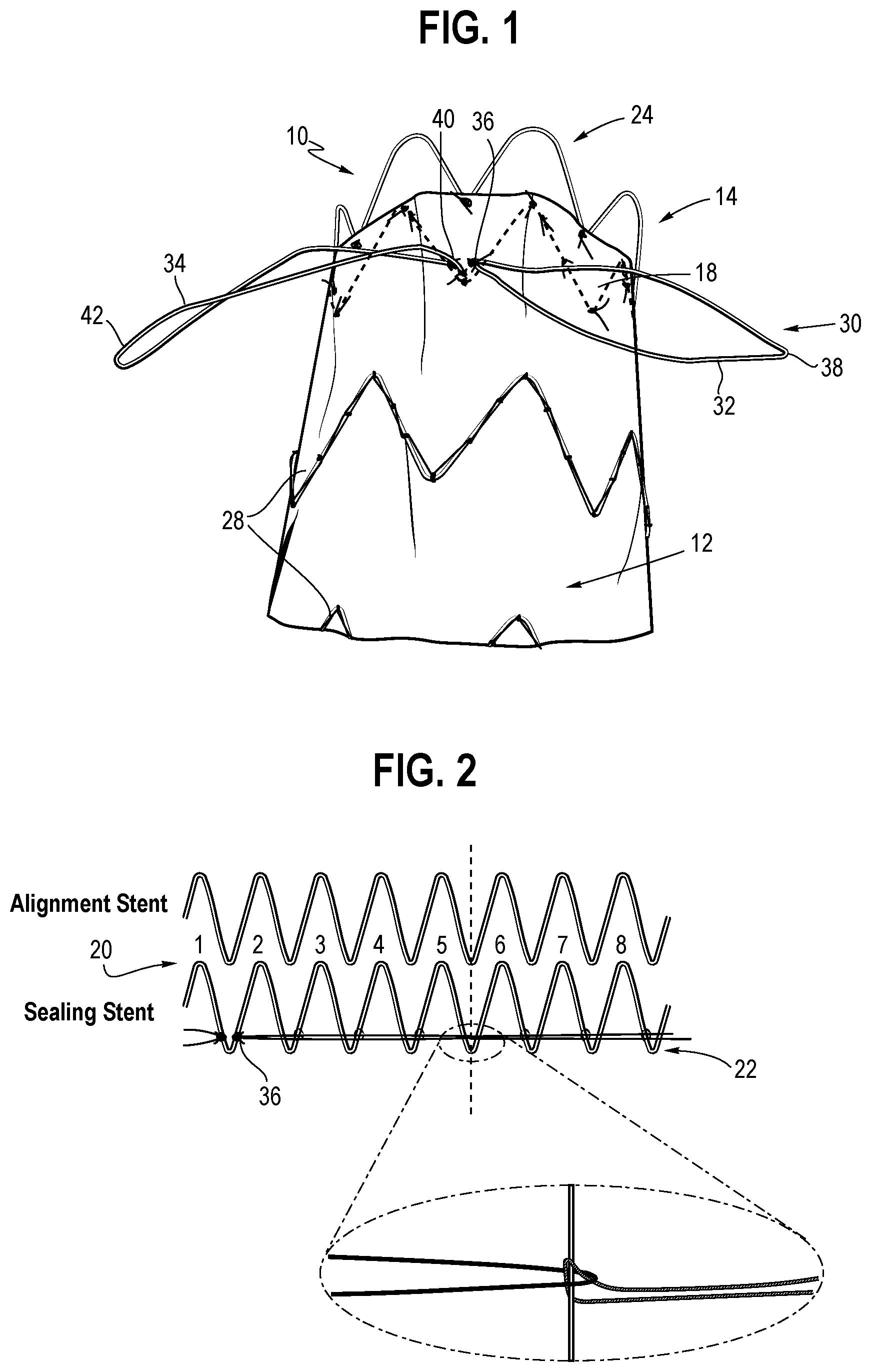 Patent US12508119 Figure 1 – Stent graft