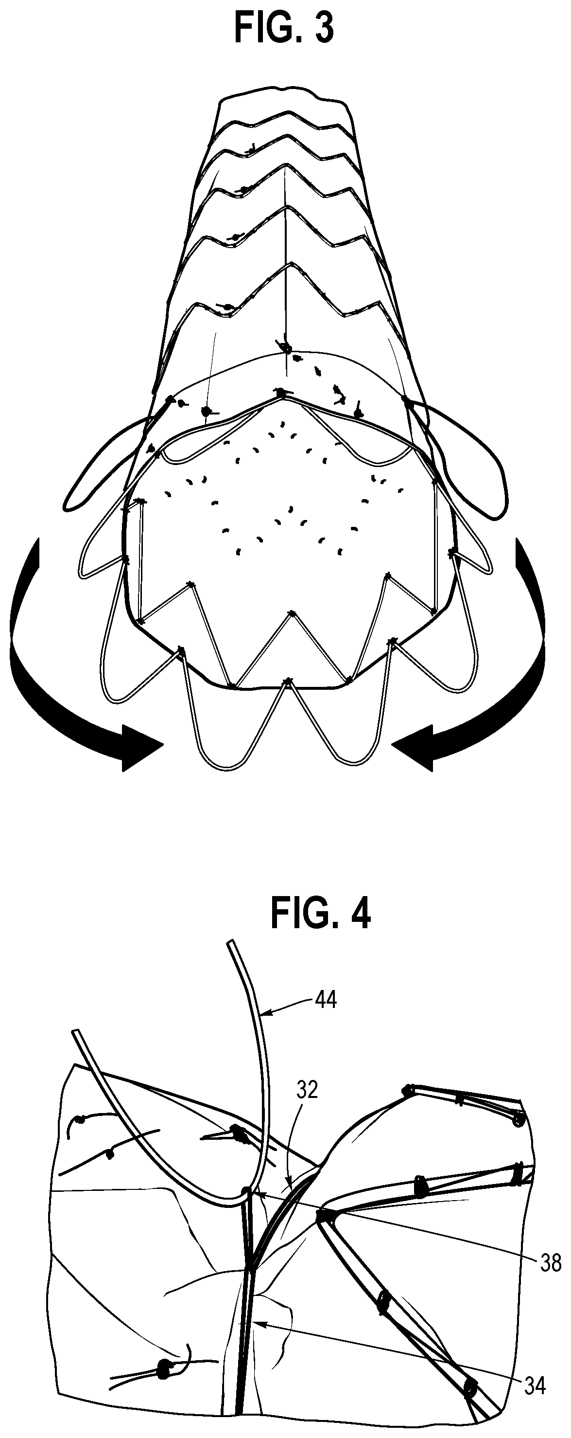 Patent US12508119 Figure 2 – Stent graft