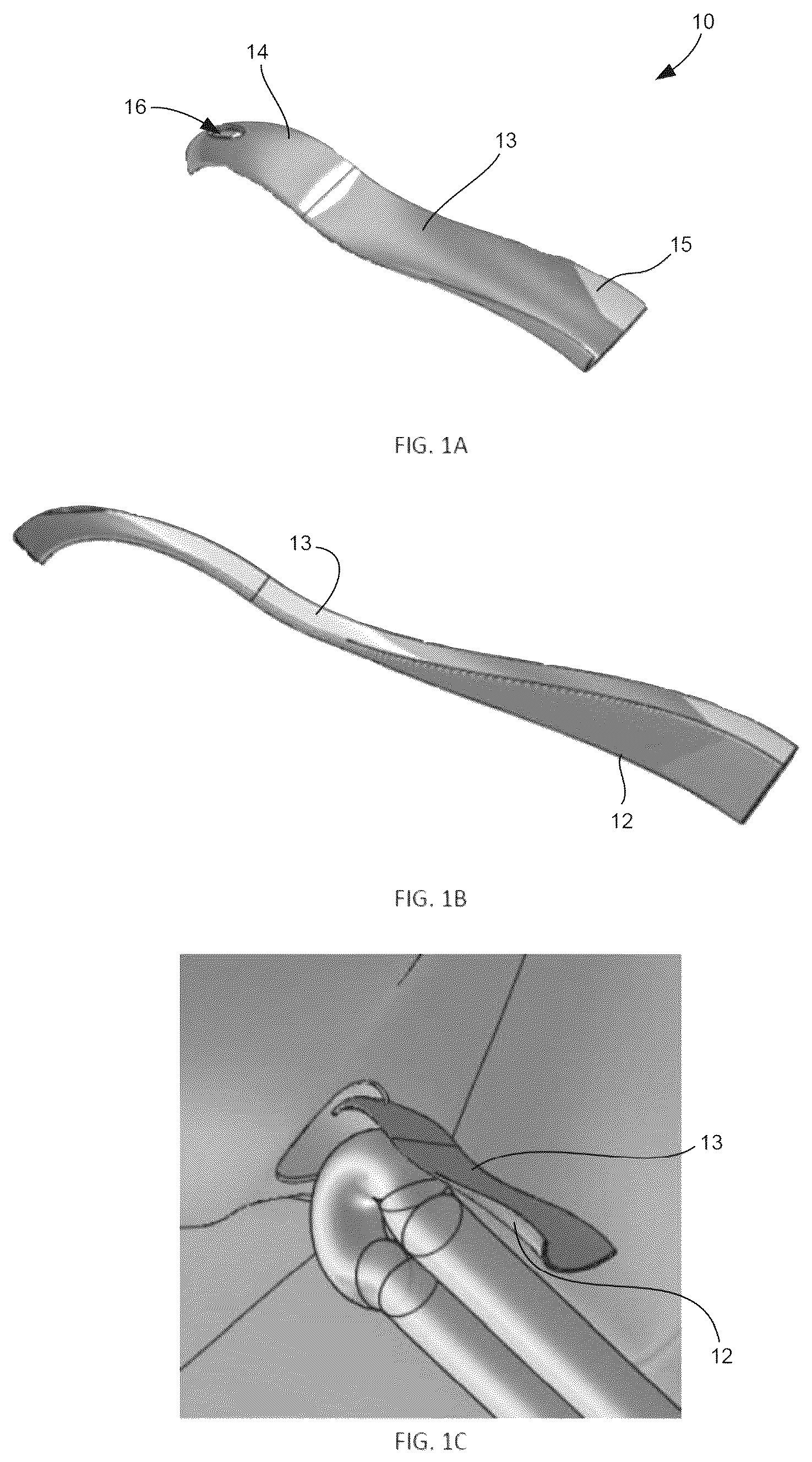 Patent US12508120 Figure 1 – Instrumentation for soft tissue reconstruction