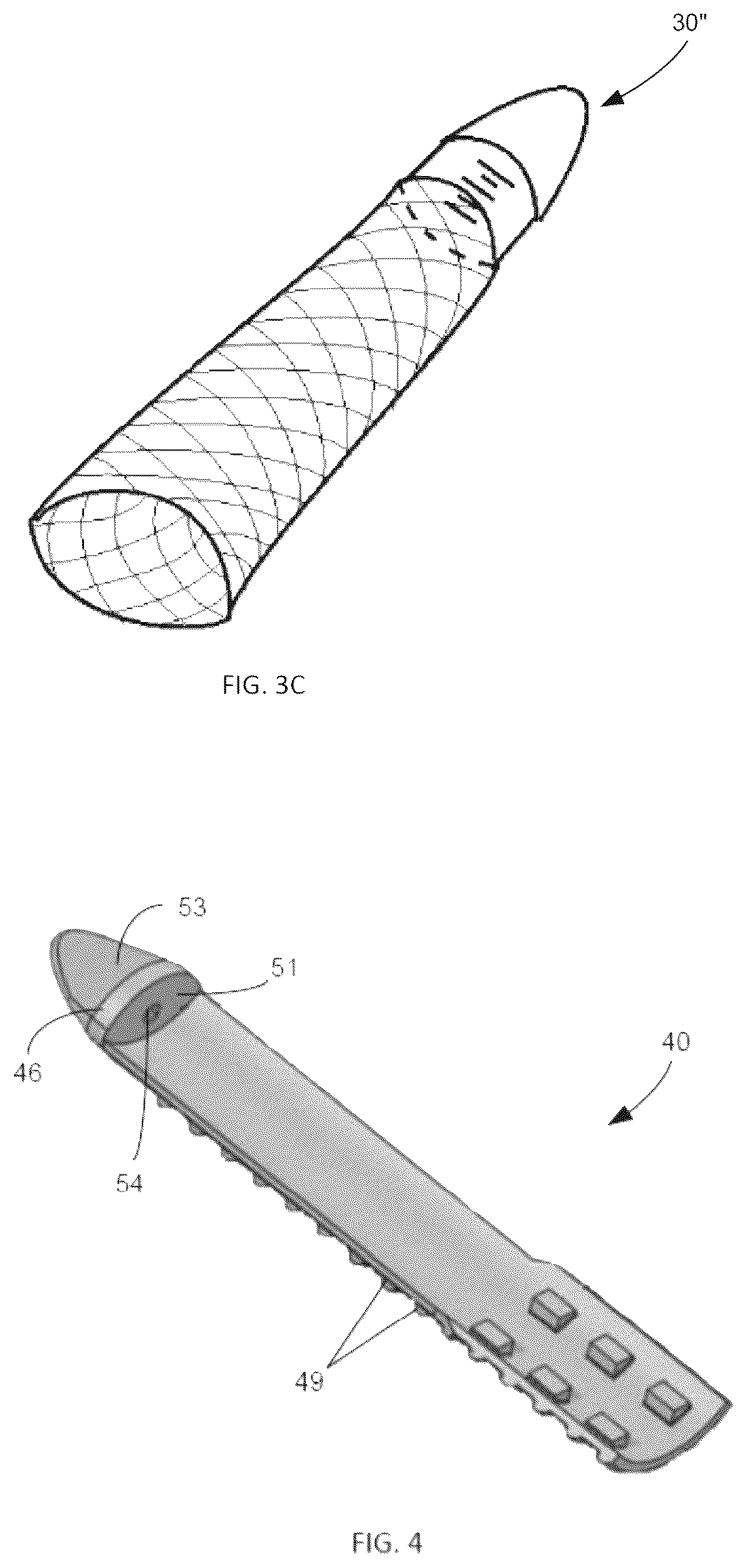 Patent US12508120 Figure 3 – Instrumentation for soft tissue reconstruction