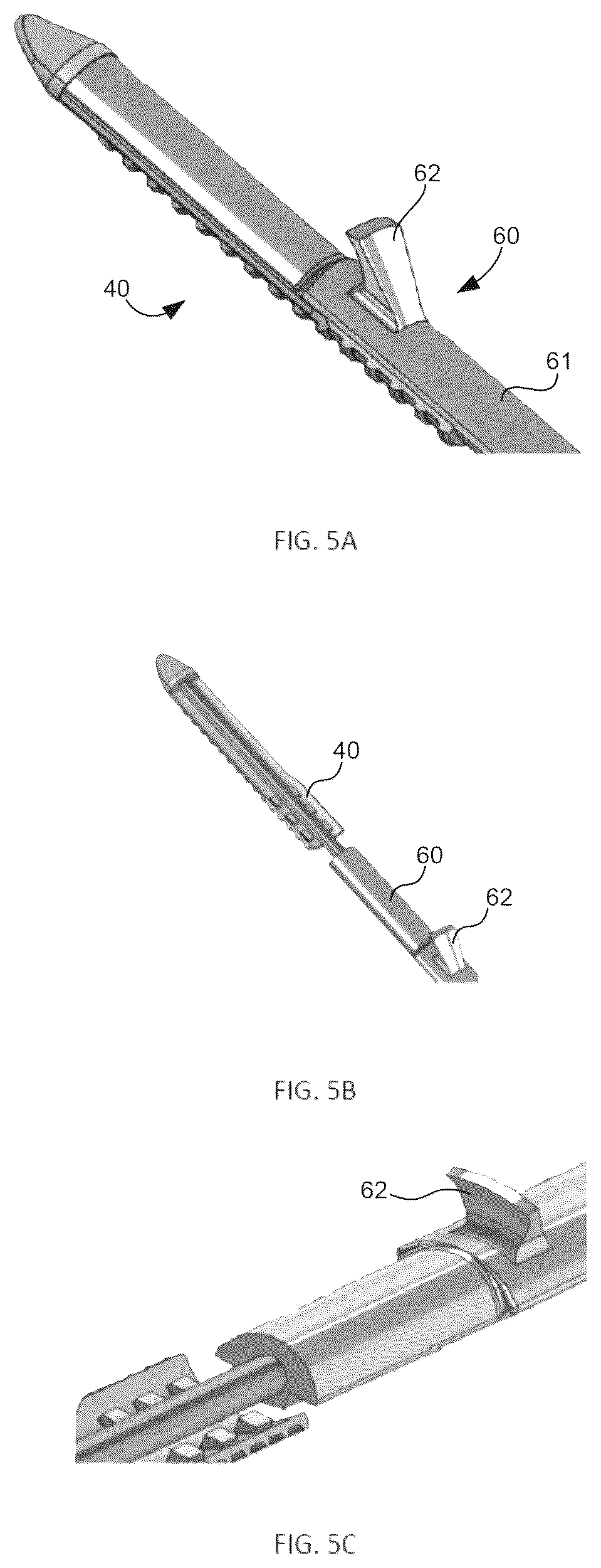 Patent US12508120 Figure 4 – Instrumentation for soft tissue reconstruction