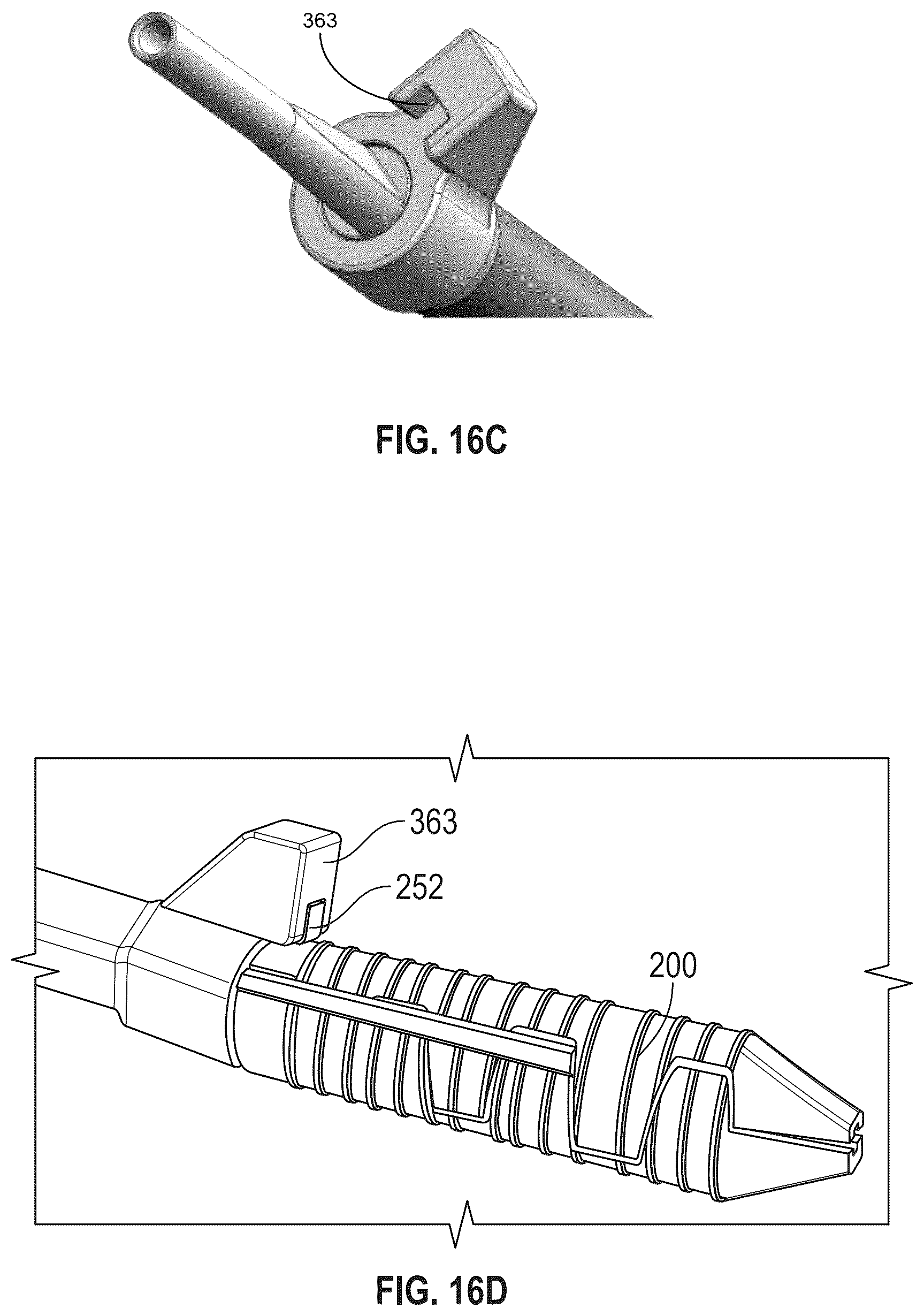 Patent US12508120 Figure 14 – Instrumentation for soft tissue reconstruction