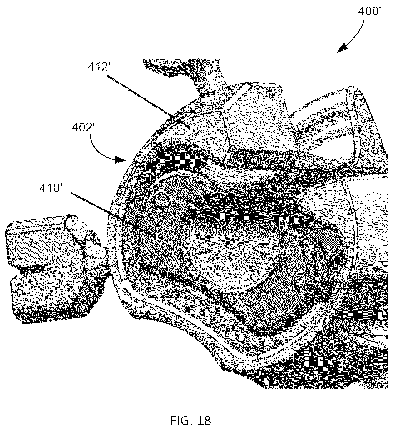 Patent US12508120 Figure 17 – Instrumentation for soft tissue reconstruction