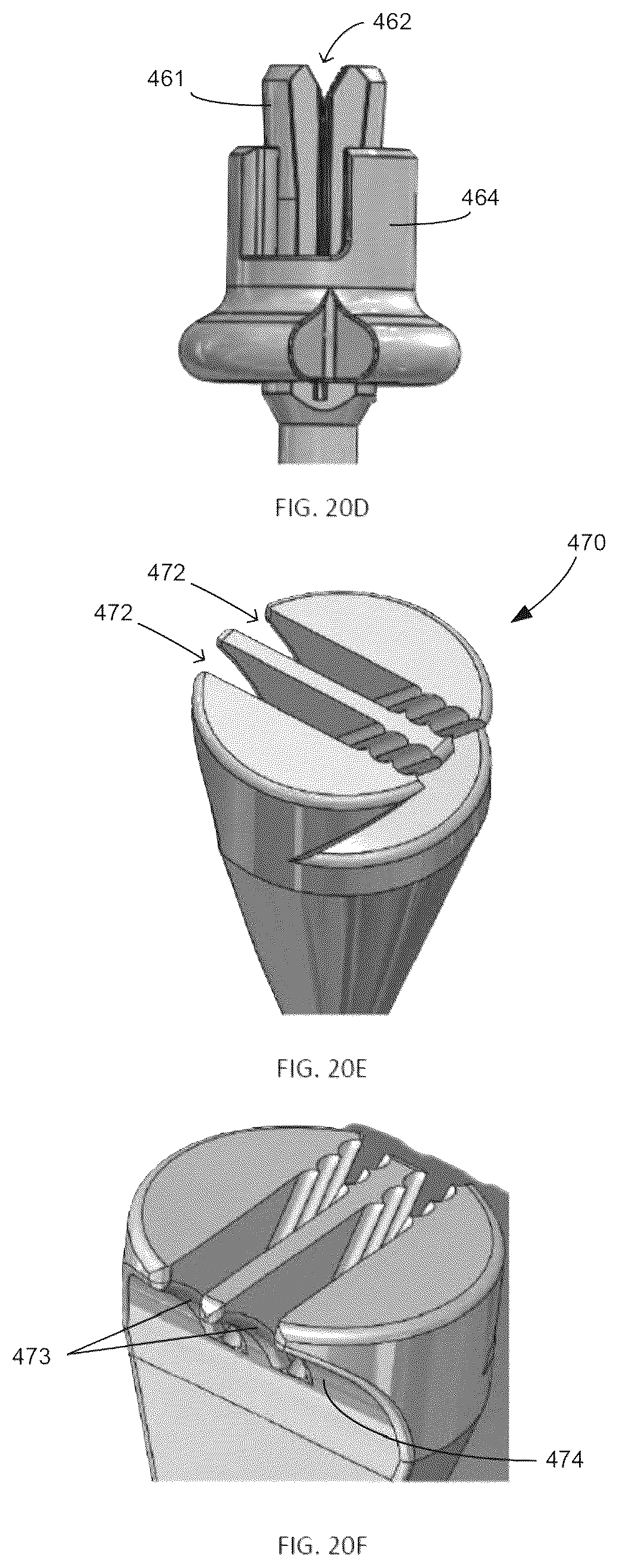 Patent US12508120 Figure 20 – Instrumentation for soft tissue reconstruction