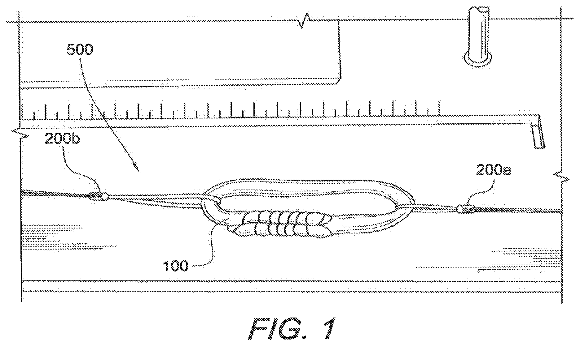 Patent US12508121 — Reinforced biological construct and method of reinforcing biological construct — Figure 1