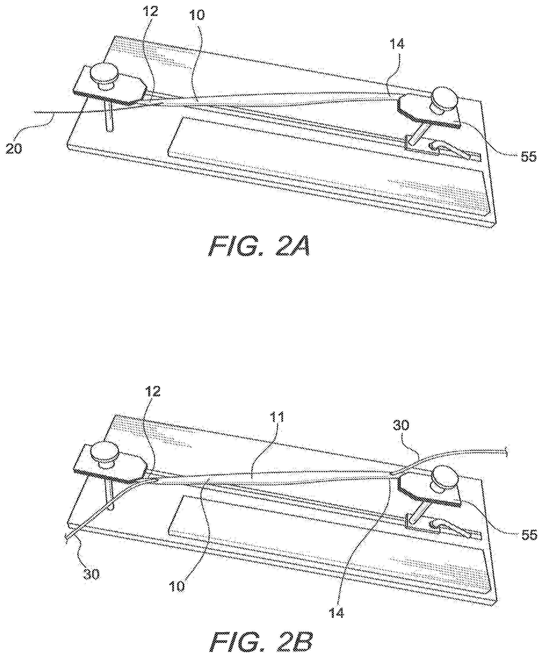 Patent US12508121 Figure 2 – Reinforced biological construct and method of reinforcing biological construct