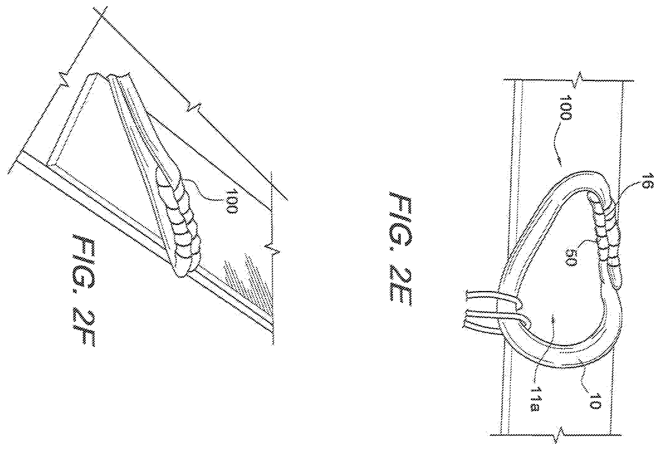 Patent US12508121 Figure 4 – Reinforced biological construct and method of reinforcing biological construct