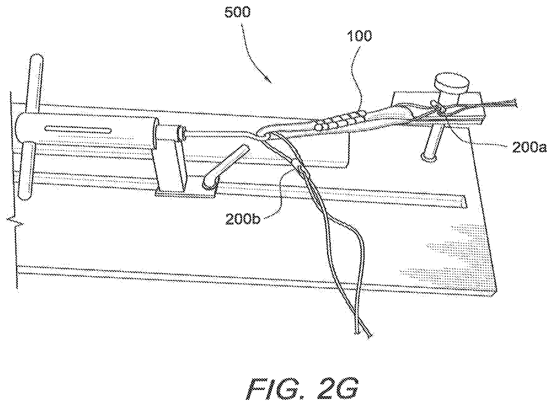 Patent US12508121 Figure 5 – Reinforced biological construct and method of reinforcing biological construct