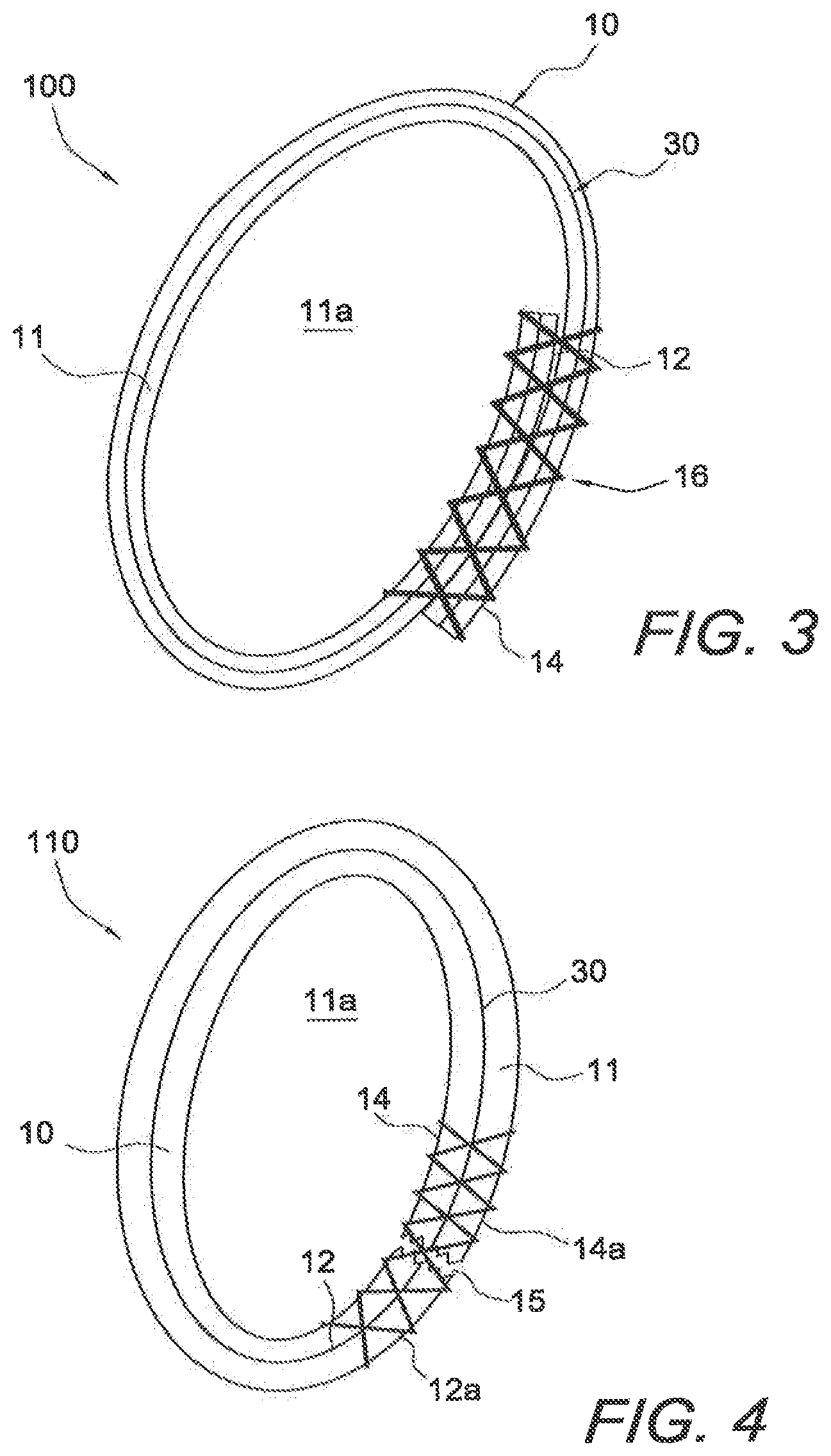 Patent US12508121 Figure 6 – Reinforced biological construct and method of reinforcing biological construct