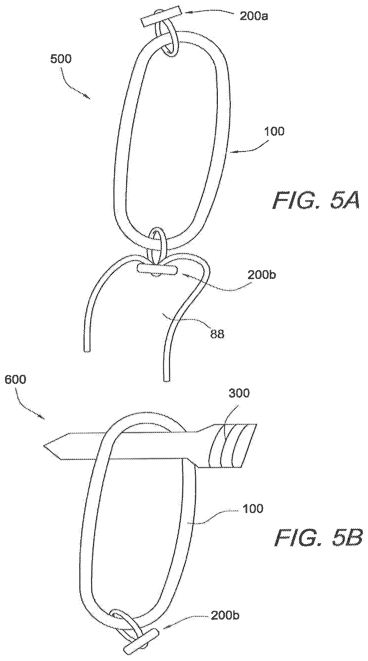 Patent US12508121 Figure 7 – Reinforced biological construct and method of reinforcing biological construct