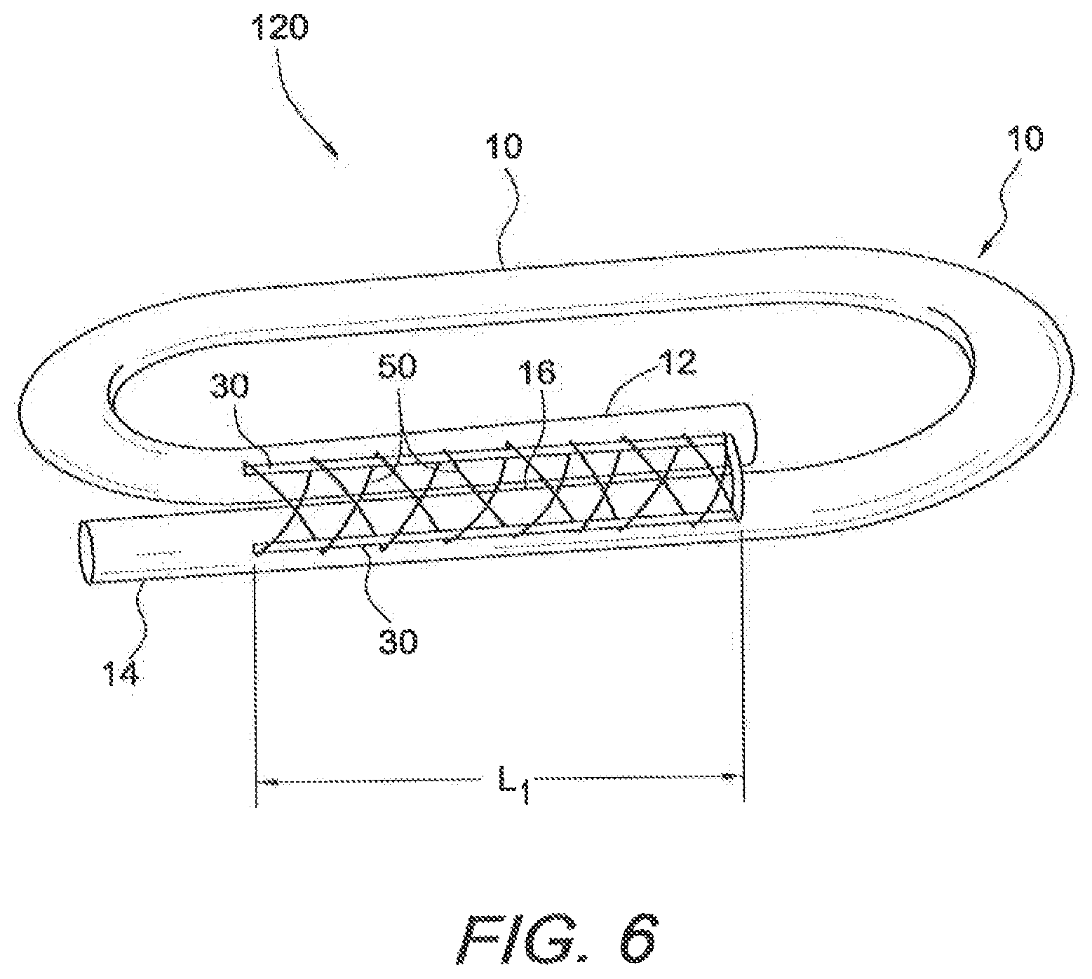 Patent US12508121 Figure 8 – Reinforced biological construct and method of reinforcing biological construct