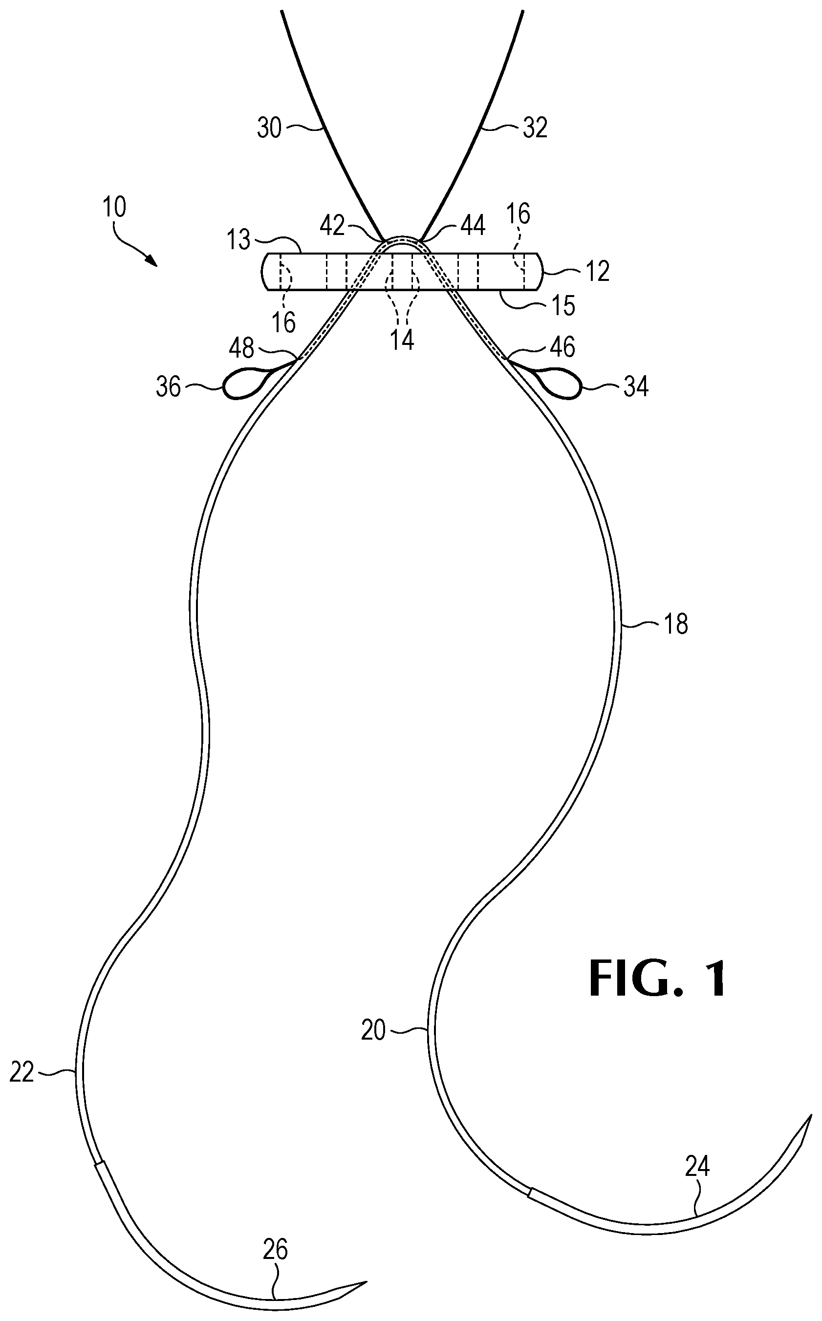 Patent US12508122 — Method of forming a suture-button-graft combination and facilitating construct — Figure 1
