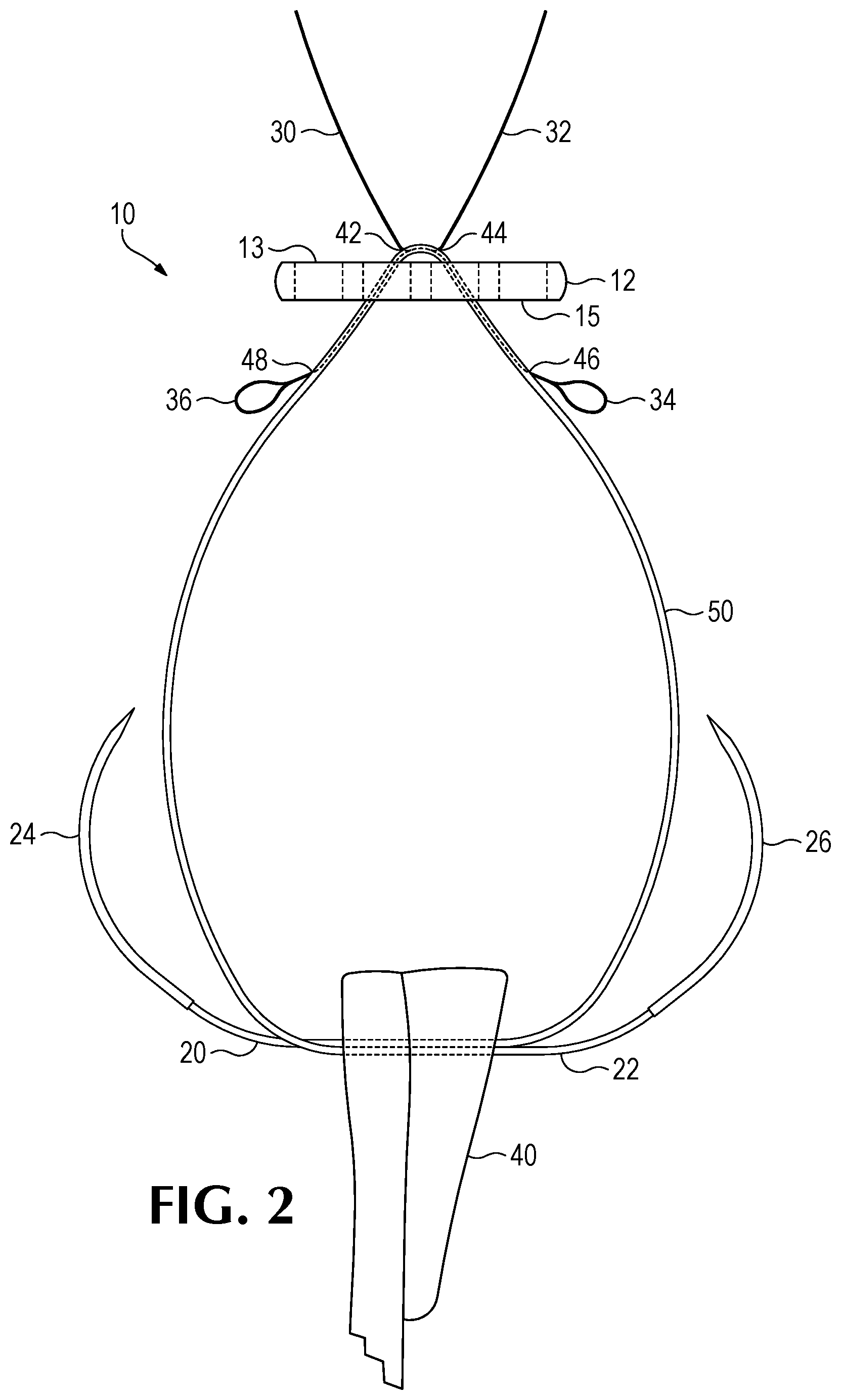 Patent US12508122 Figure 2 – Method of forming a suture-button-graft combination and facilitating construct
