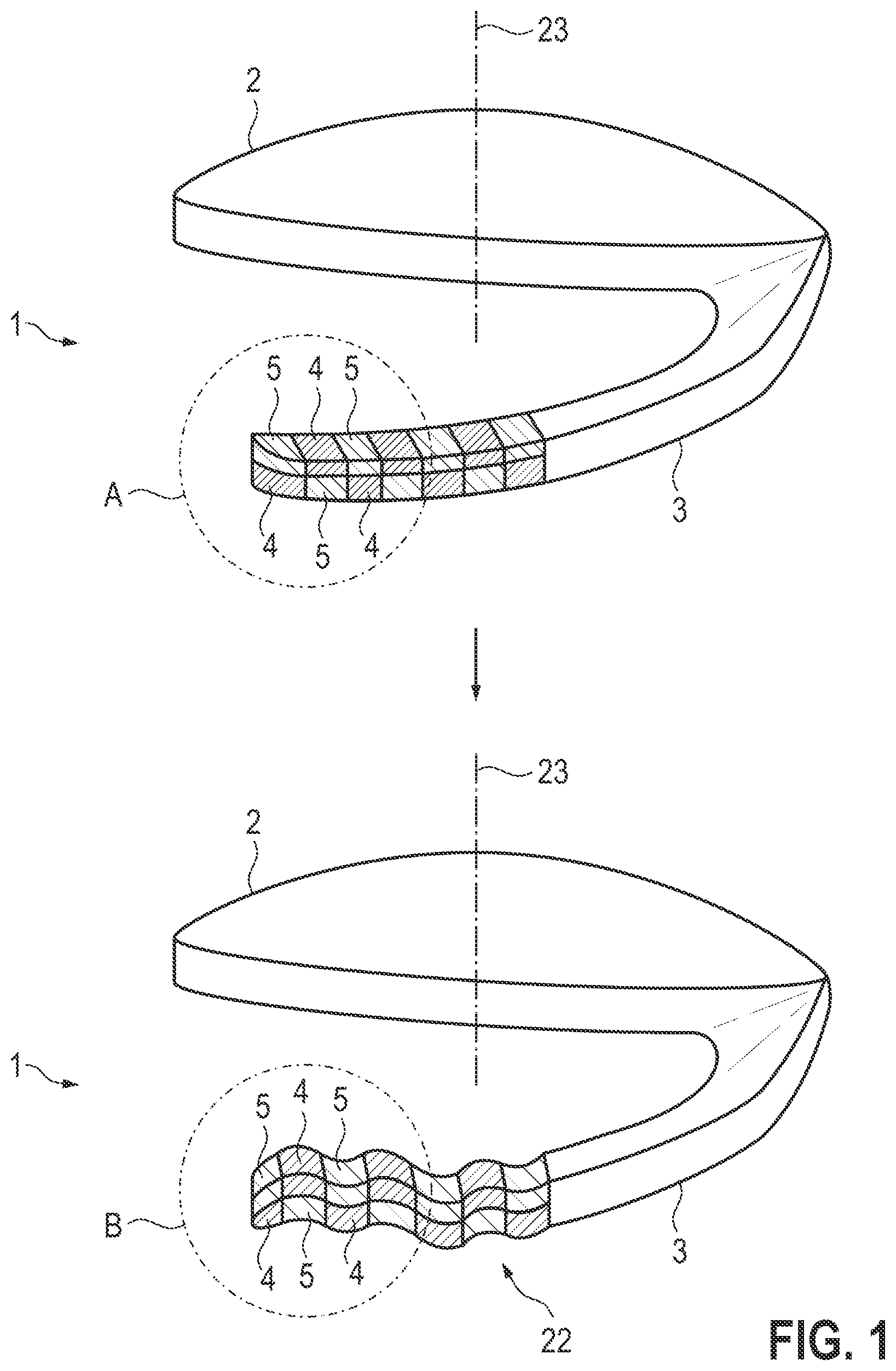 Patent US12508123 — Intraocular lens and treatment apparatus — Figure 1