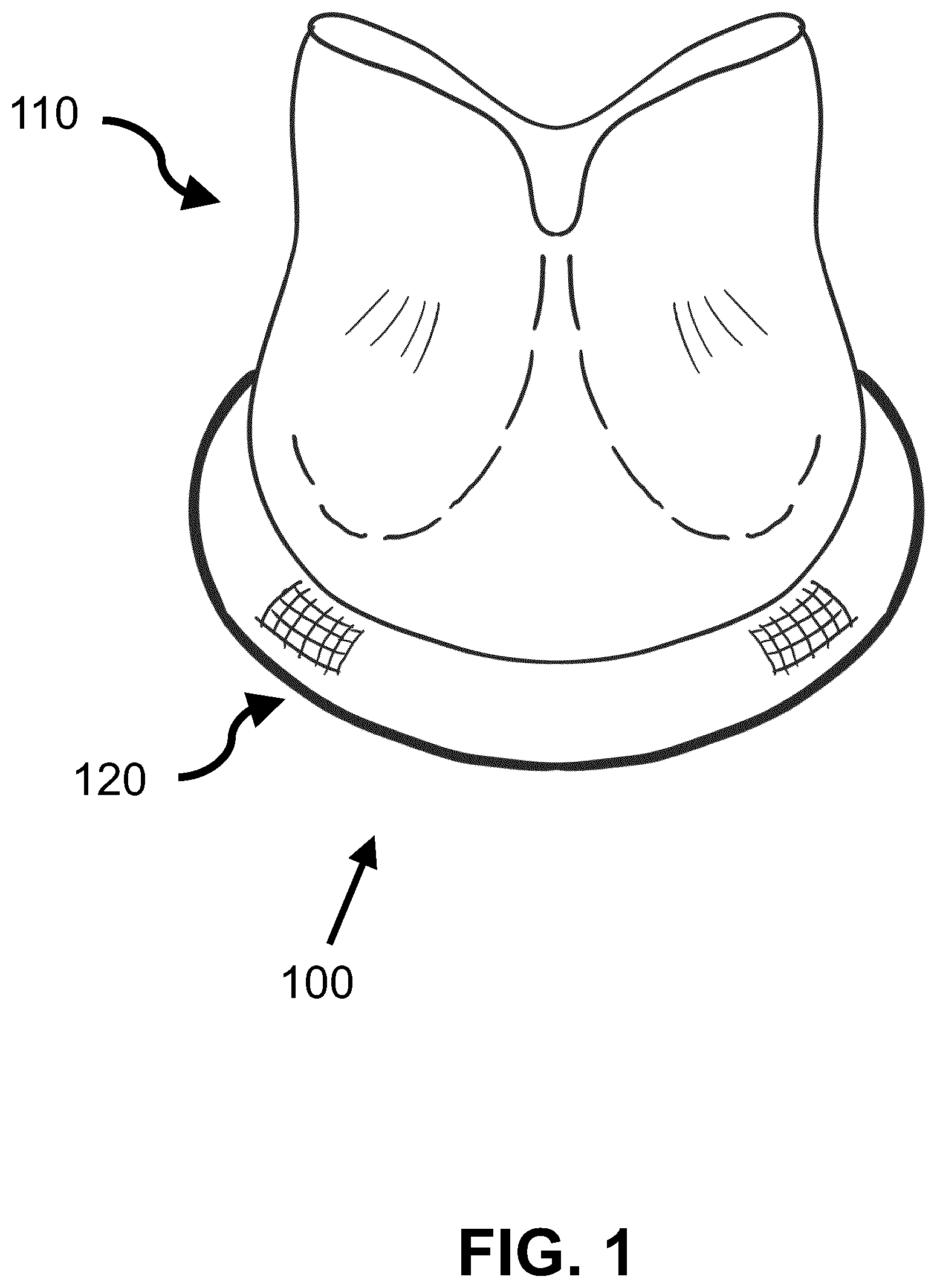 Patent US12508125 Figure 1 – Electrospun suture ring