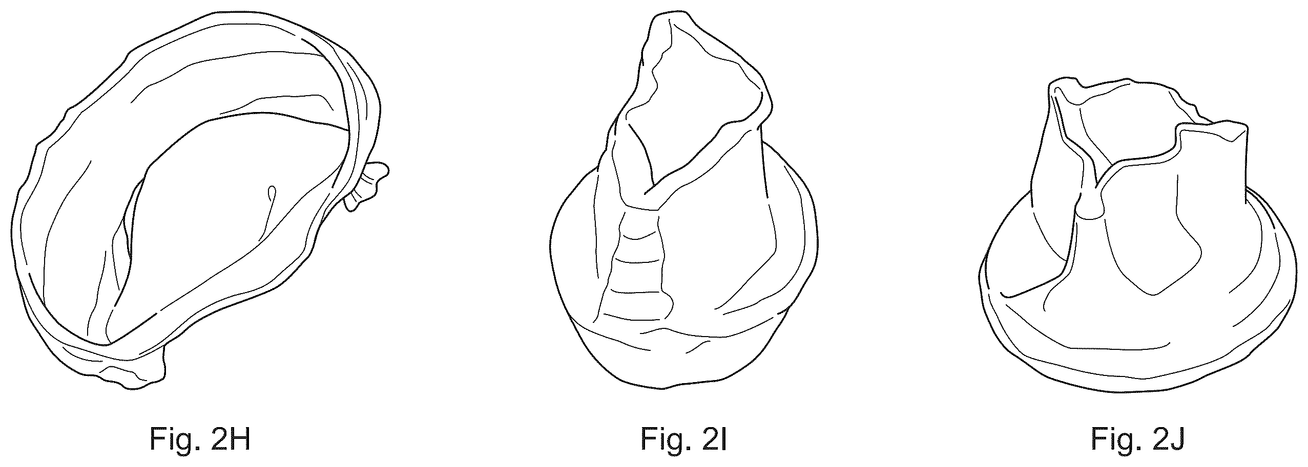 Patent US12508126 Figure 6 – Double component mandrel for electrospun stentless, multi-leaflet valve fabrication