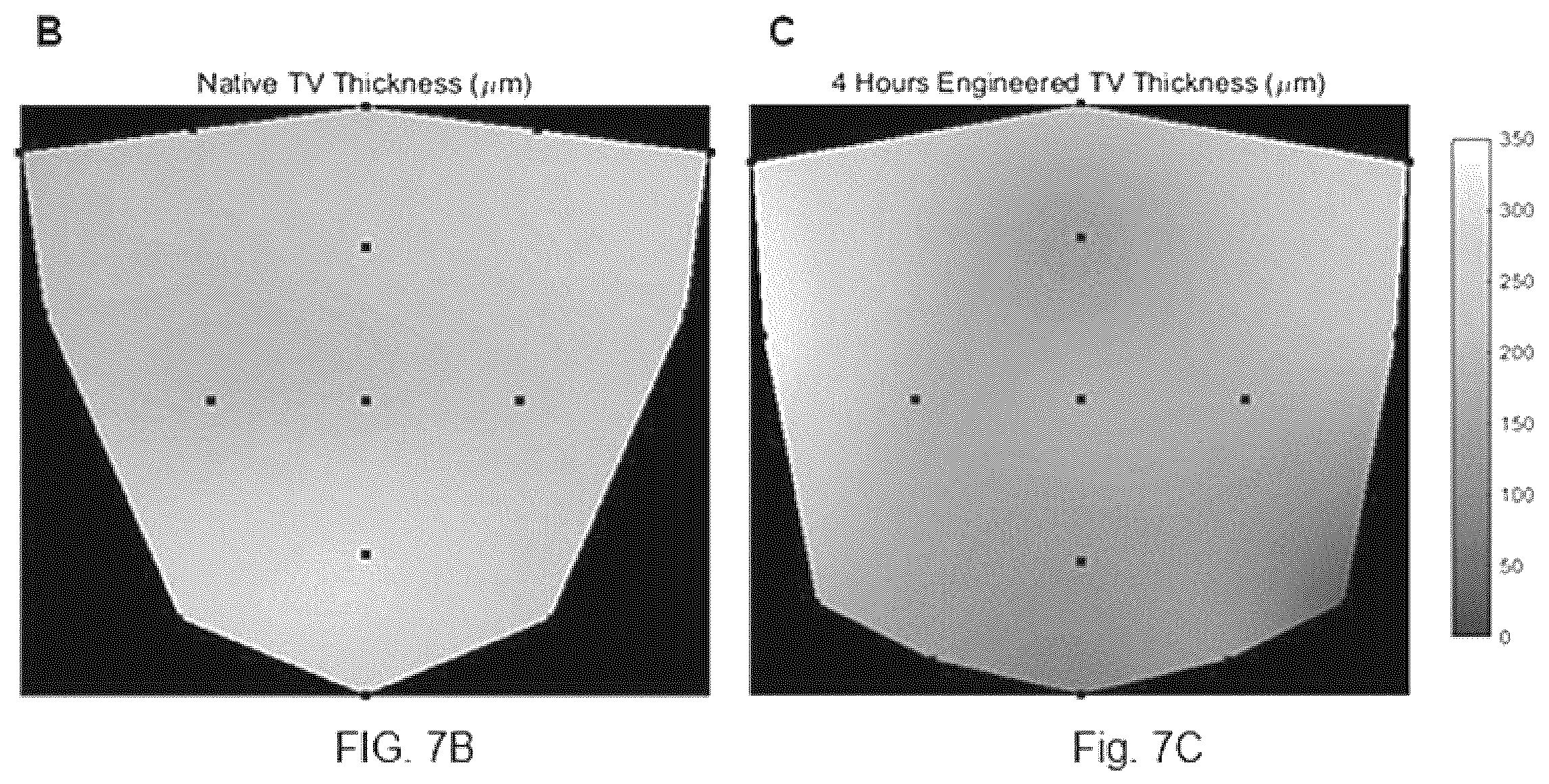 Patent US12508126 Figure 12 – Double component mandrel for electrospun stentless, multi-leaflet valve fabrication
