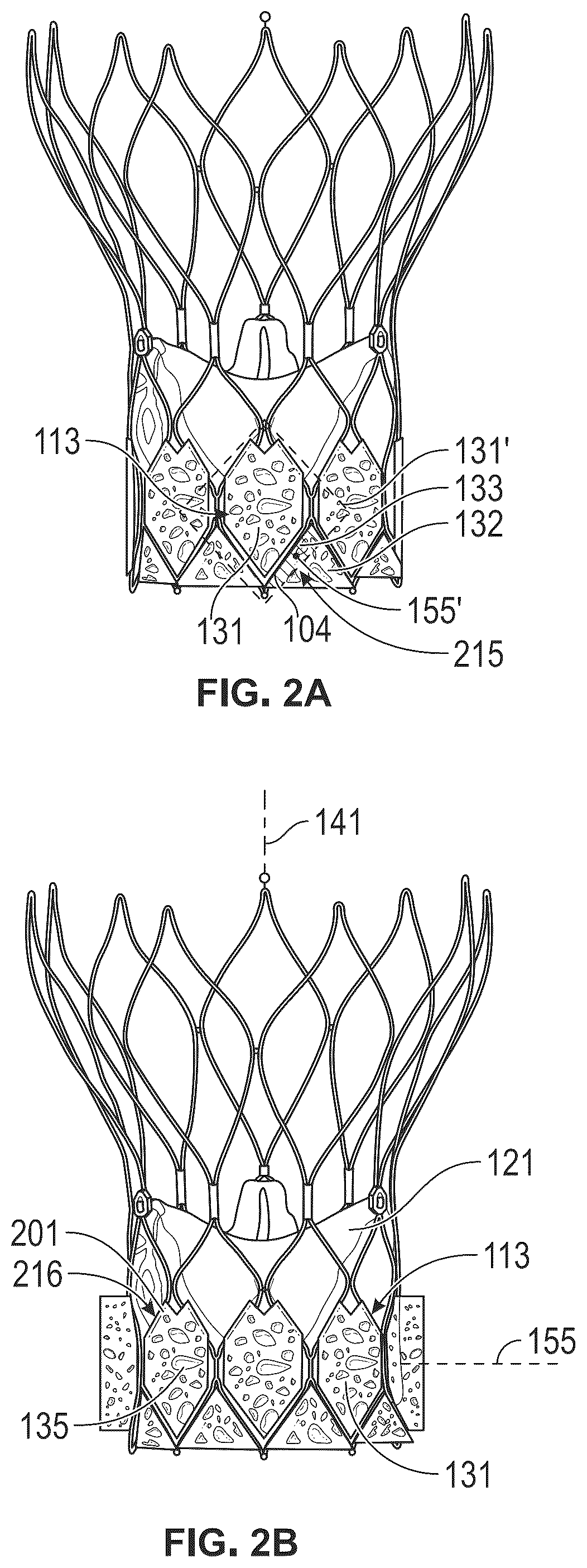 Patent US12508127 Figure 2 – Shape memory polymer foams to seal space around valves